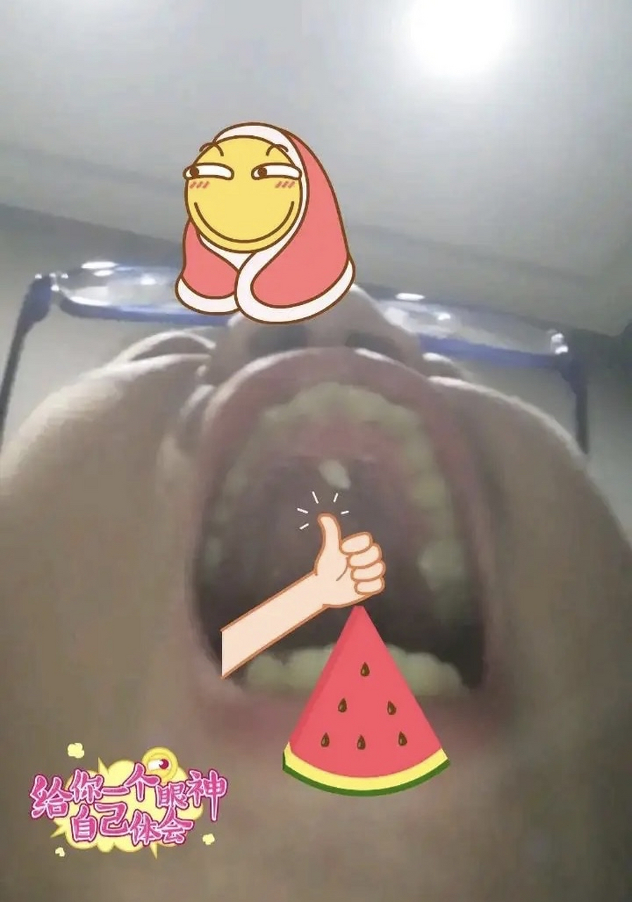 友友们上颚长了颗牙怎么办,虽然不影响什么