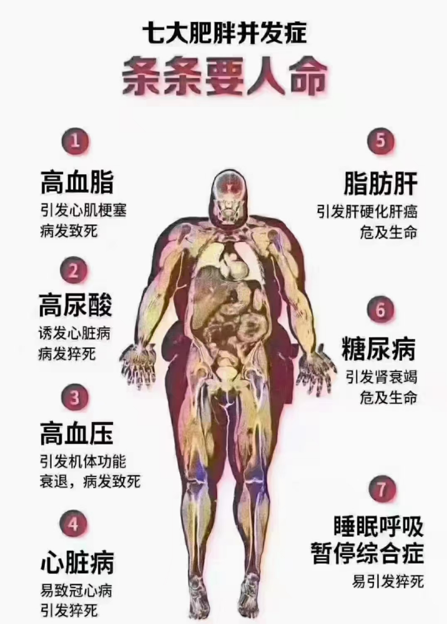 高尿酸  心脏病  脂肪肝  糖尿病  睡眠呼吸暂停综合症  肥胖七大并发