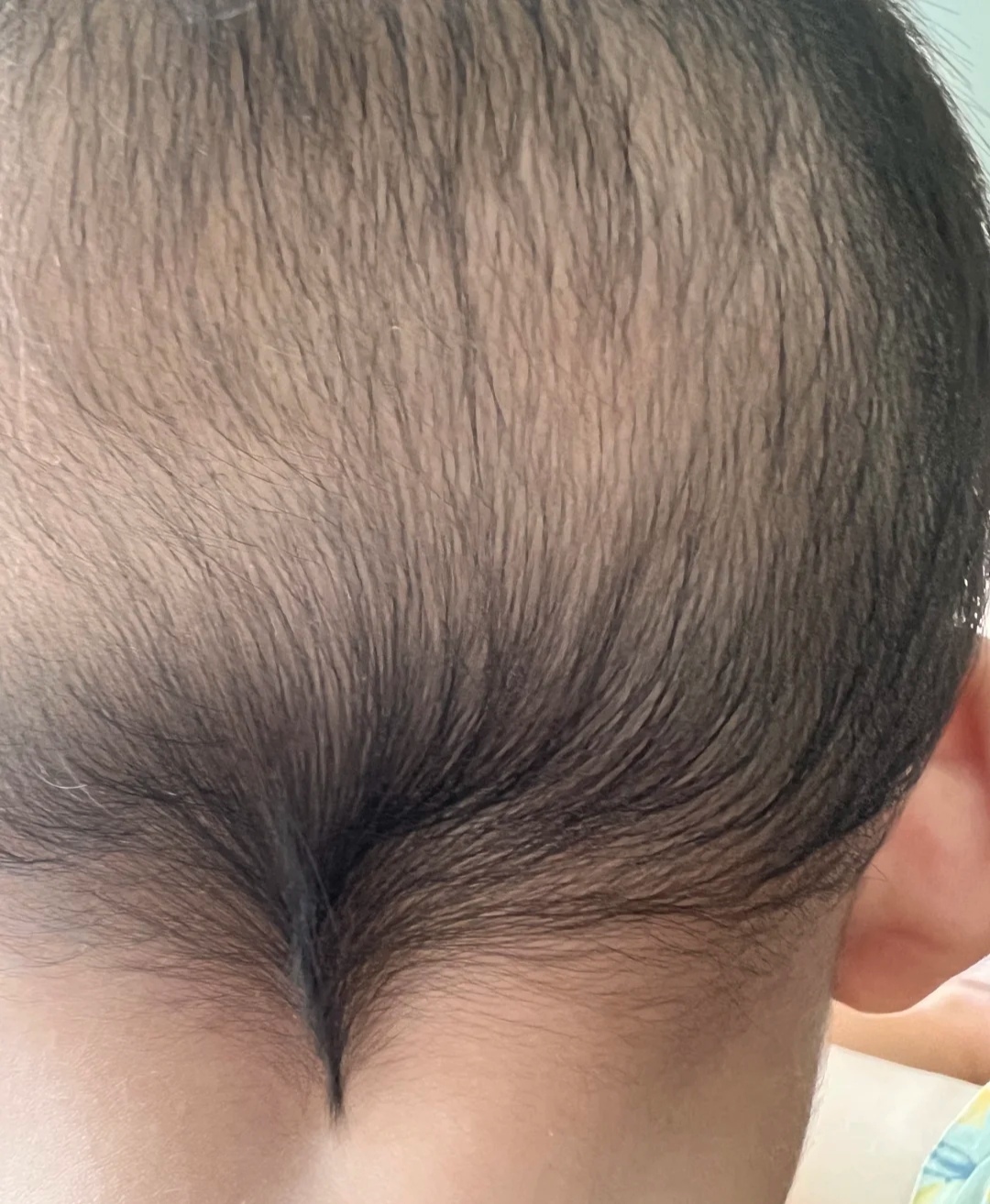 孩子脑袋后面长了个小尖尖,姥姥居然说这是毛笔,还断言以后孩子肯定是