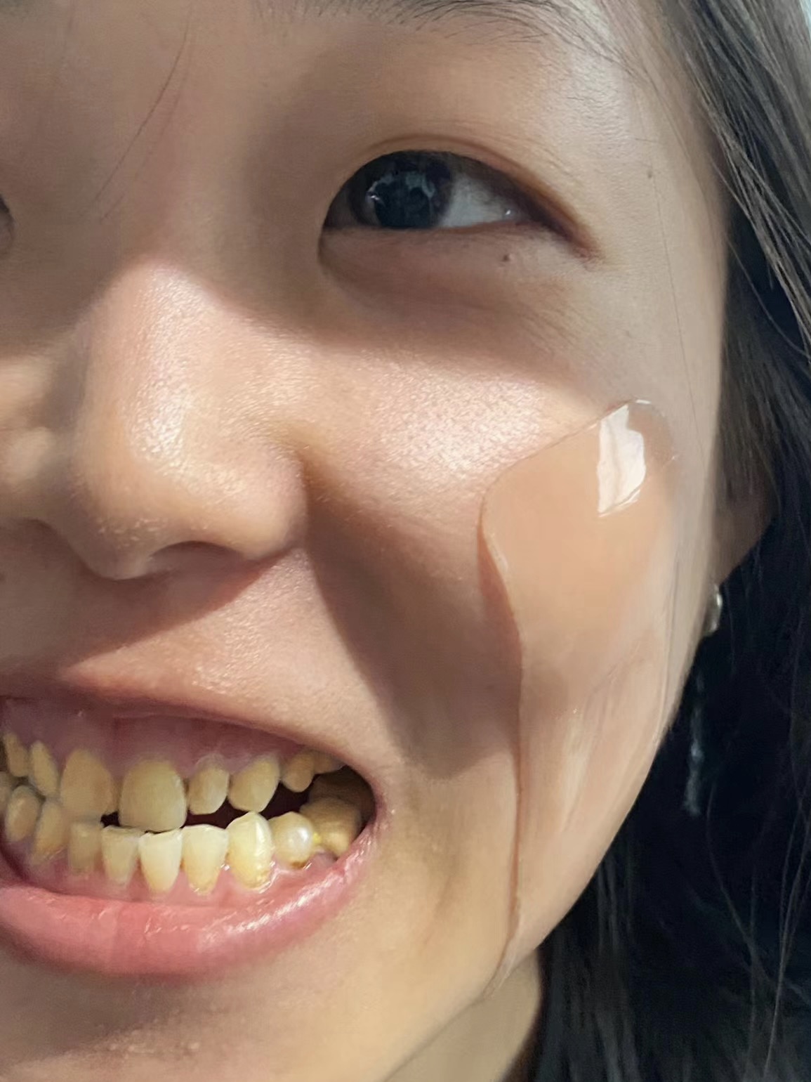 牙齿会黄吗牙齿上半节黄下半节白牙黄灰女人遗传黄牙为什么牙齿总是