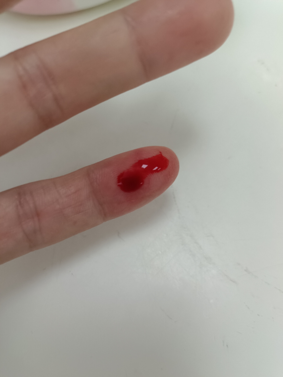 人一倒霉起来就连喝水都塞牙缝,真的是这样的.