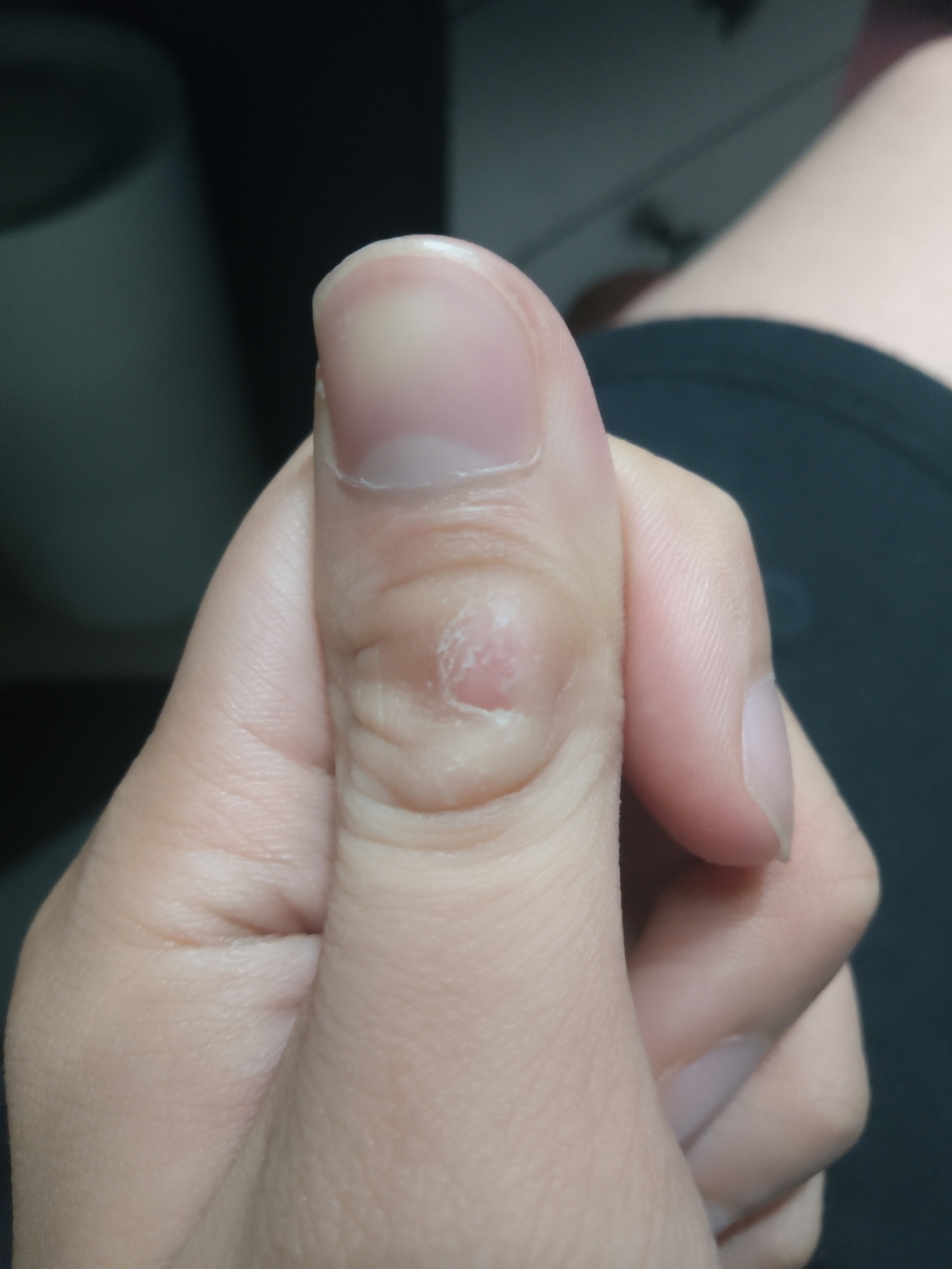 想问一下这是什么生了有一年多了,本来就很小一个