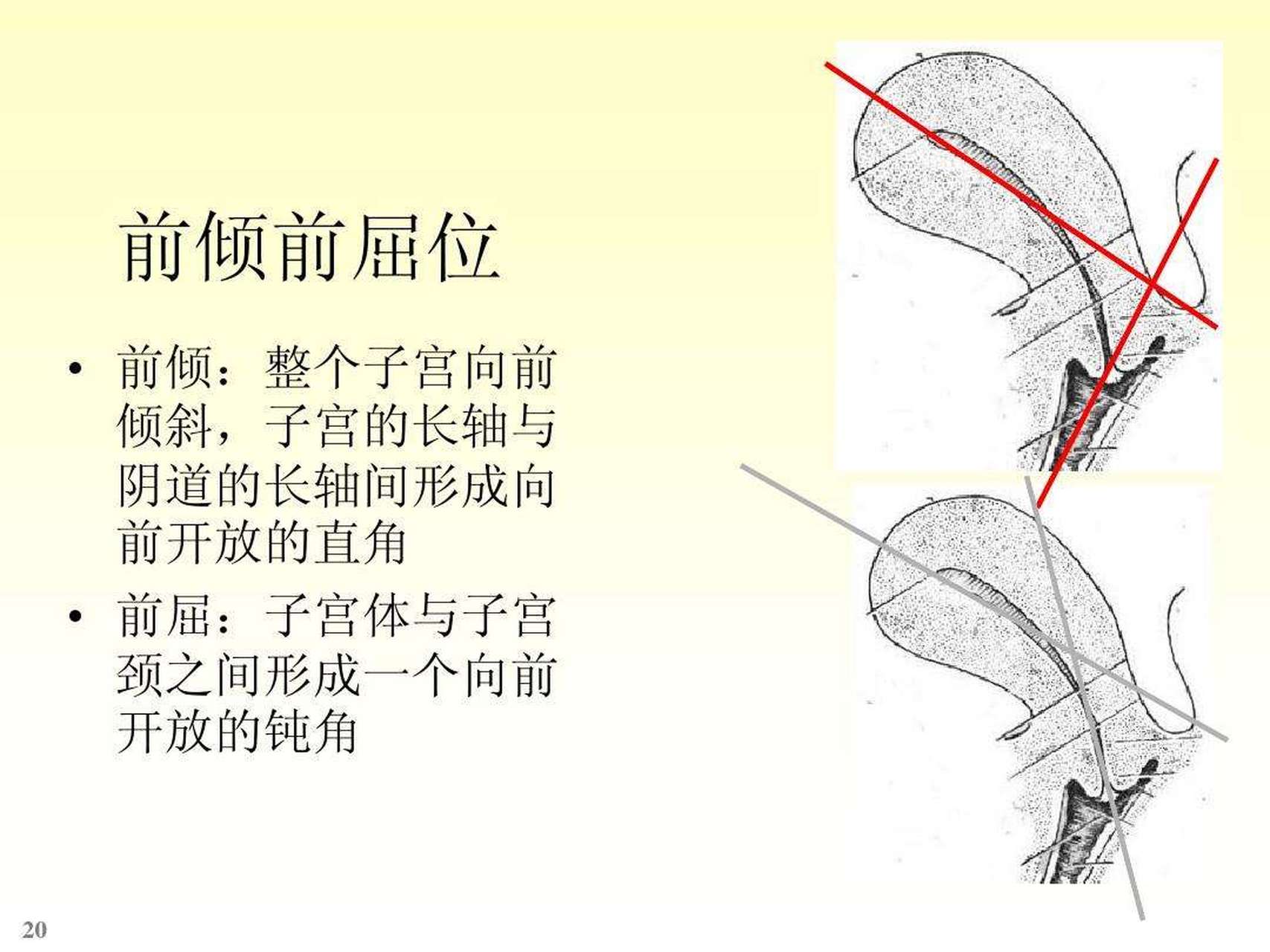 女人的子宫可以分为三个体位:子宫前倾,正位,子宫后倾!