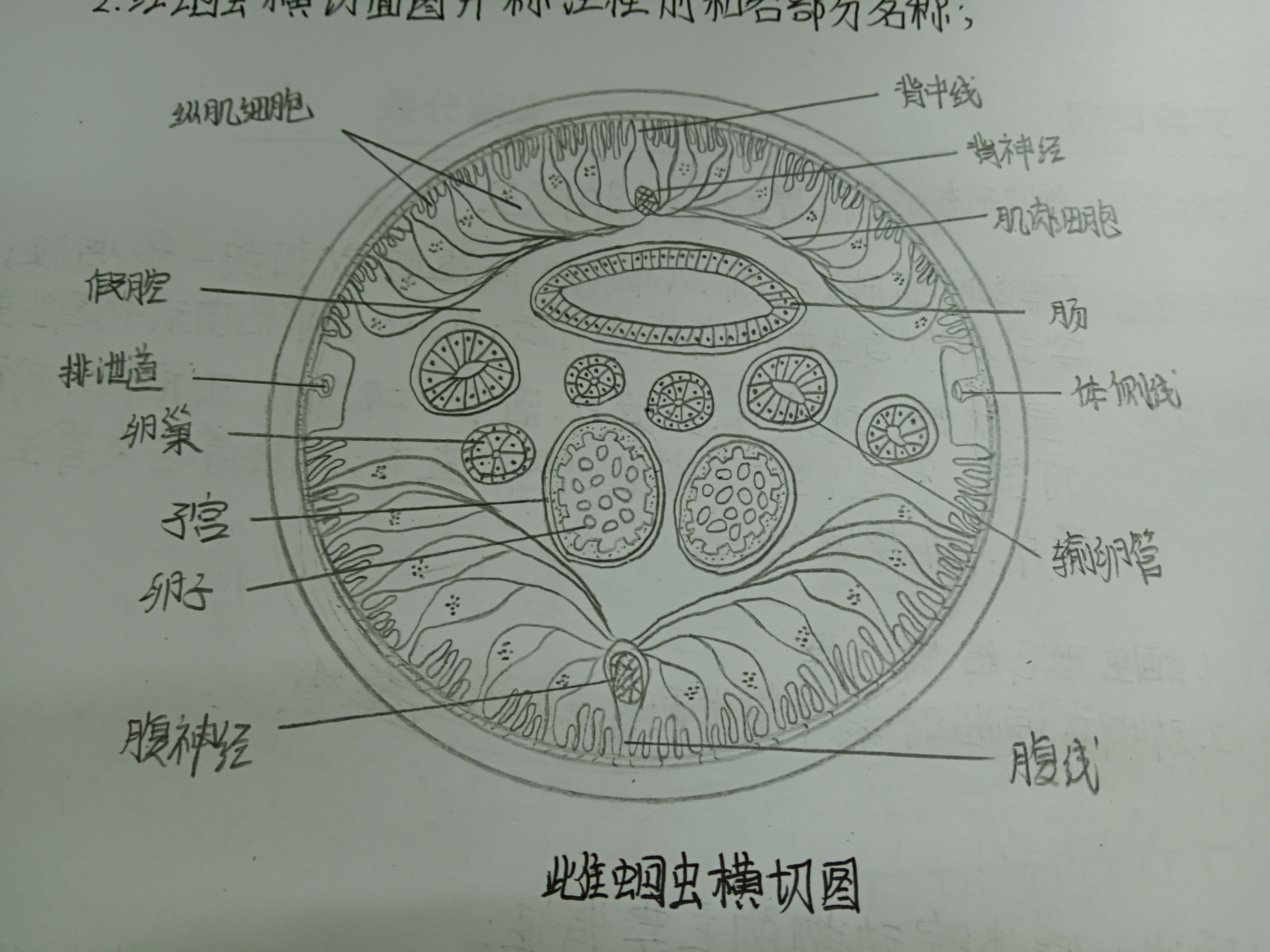 布氏姜片吸虫手绘图图片