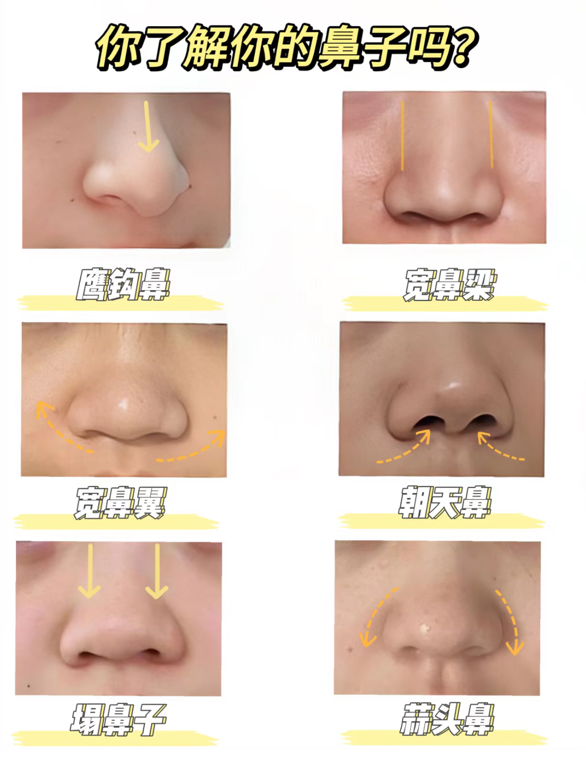 鼻钩吊鼻孔图片