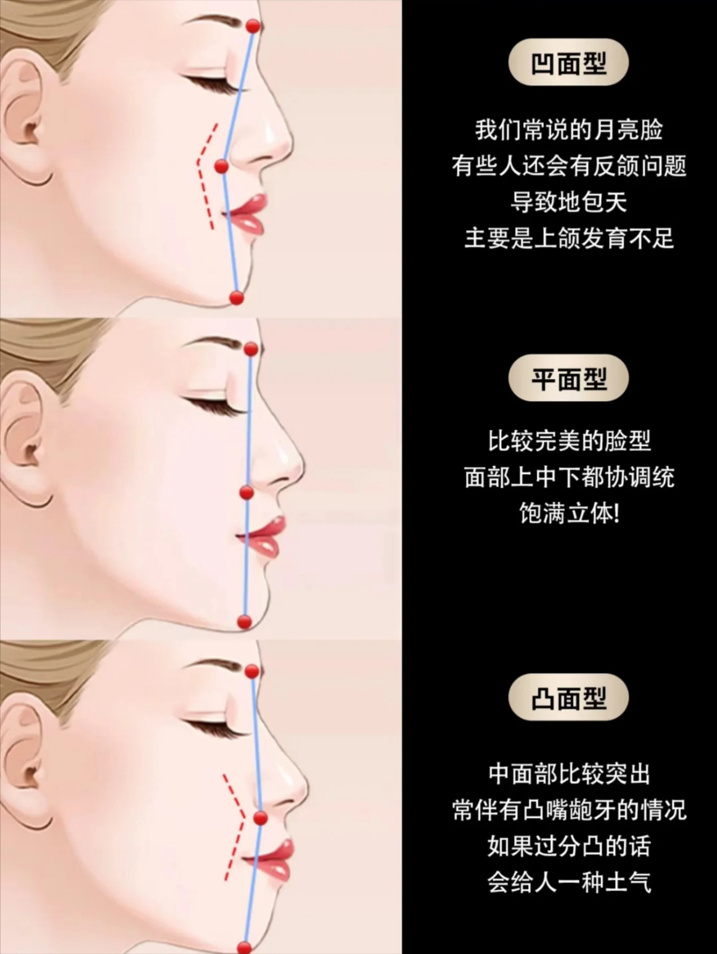 鼻基底凹陷面相图片