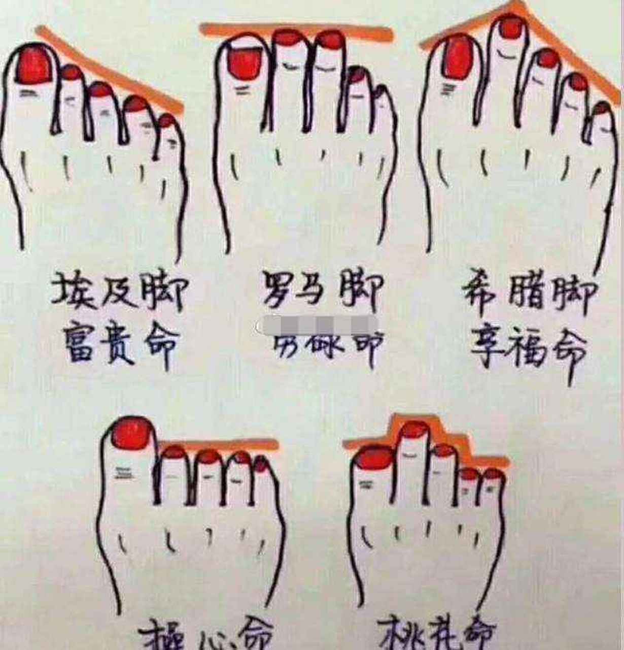 1,希腊脚    第二根脚趾最长称为希腊脚,有此脚型的人一辈子忧喜参