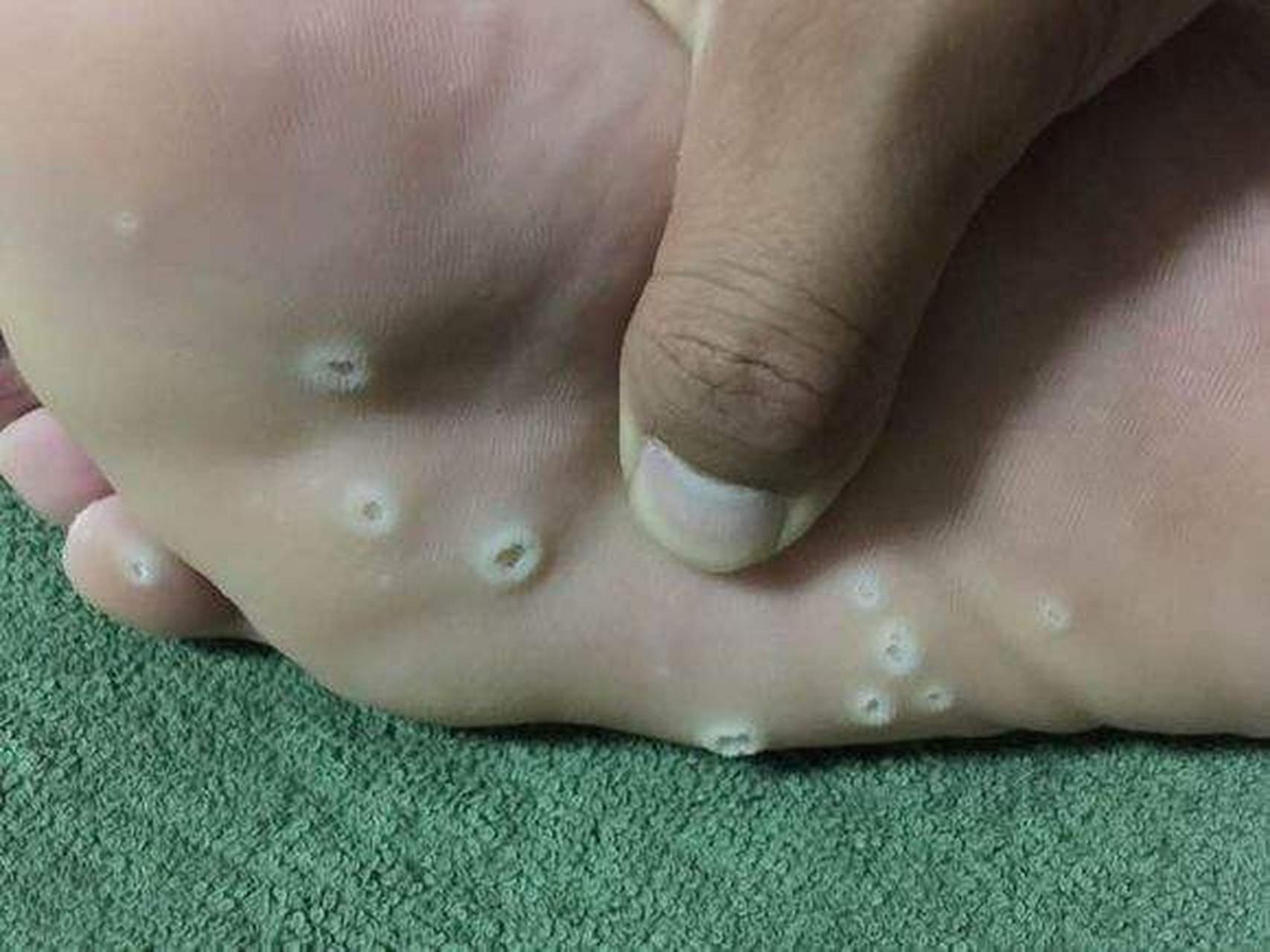高人说脚踏七星,注定不凡,三十多年过去了也没有什么成就,直到昨天