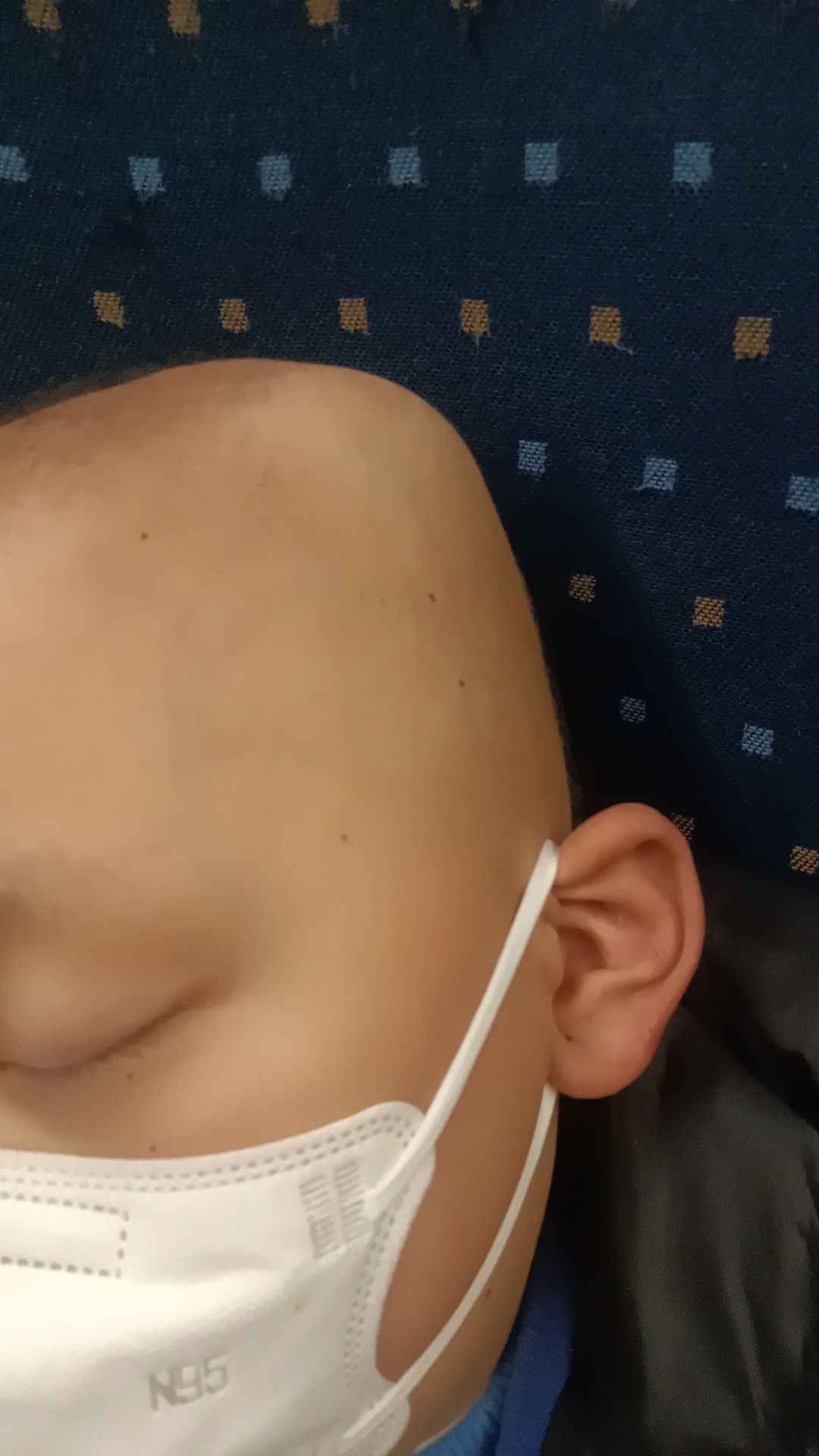 头上一次上一次严重了,腰也酸痛,头也转移了,走几步腰都不行呀!