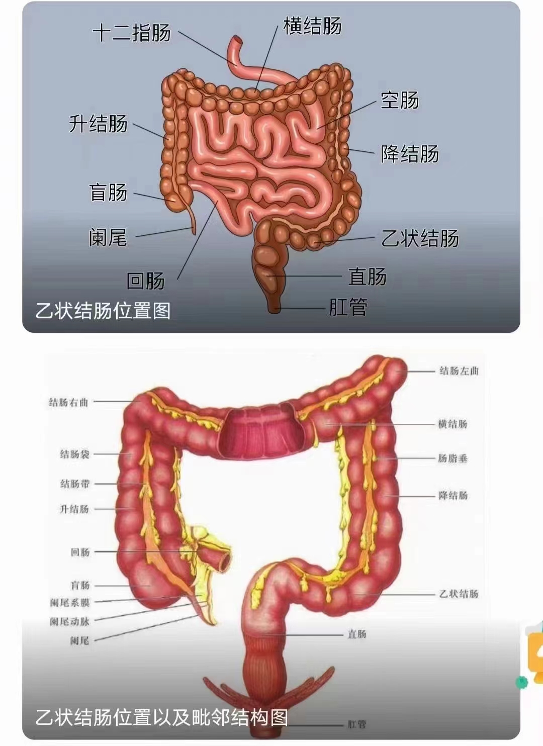 结肠癌的早期的症状通常有很多