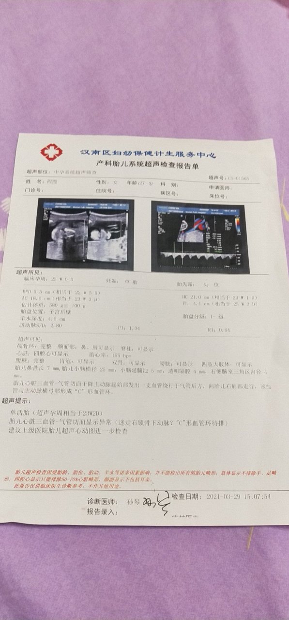 三血管气管切面示意图图片