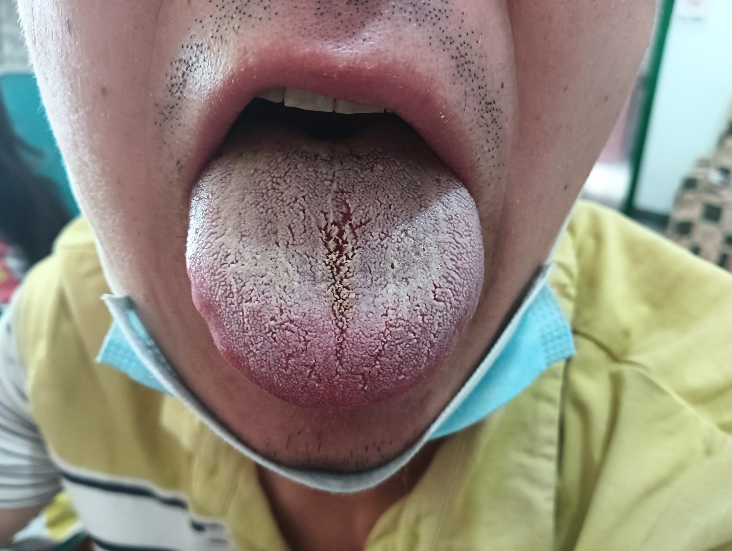 舌头上的信息是博大精深的.当然心理,环境,技术,习惯,方法都是关系