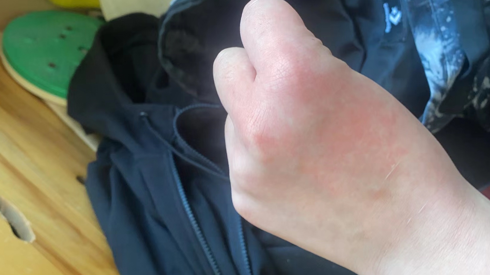 天气热身上痒怎么回事今日情况 天气热身上痒怎么回事今日情况