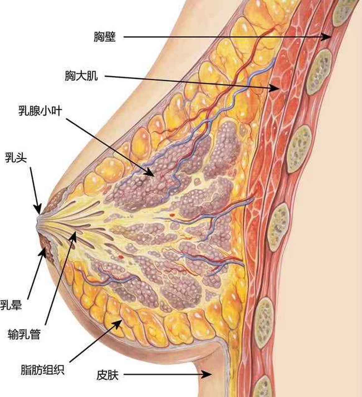 乳腺癌的演變過程:乳房有小顆粒——→小葉增生——→乳腺增生