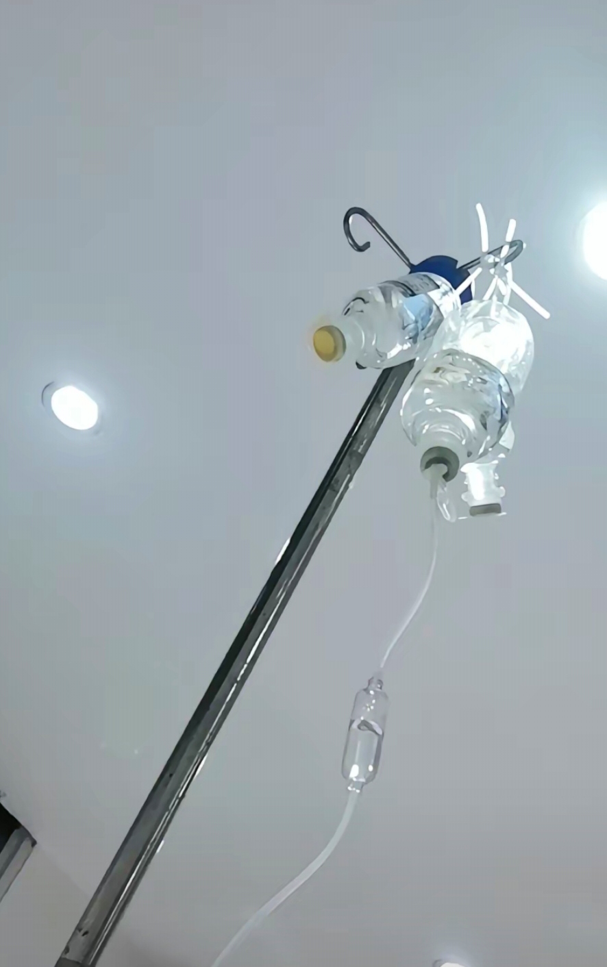 前几天,有一个孩子在诊所打针,刚打上针就出现不良现象,家属问其正常