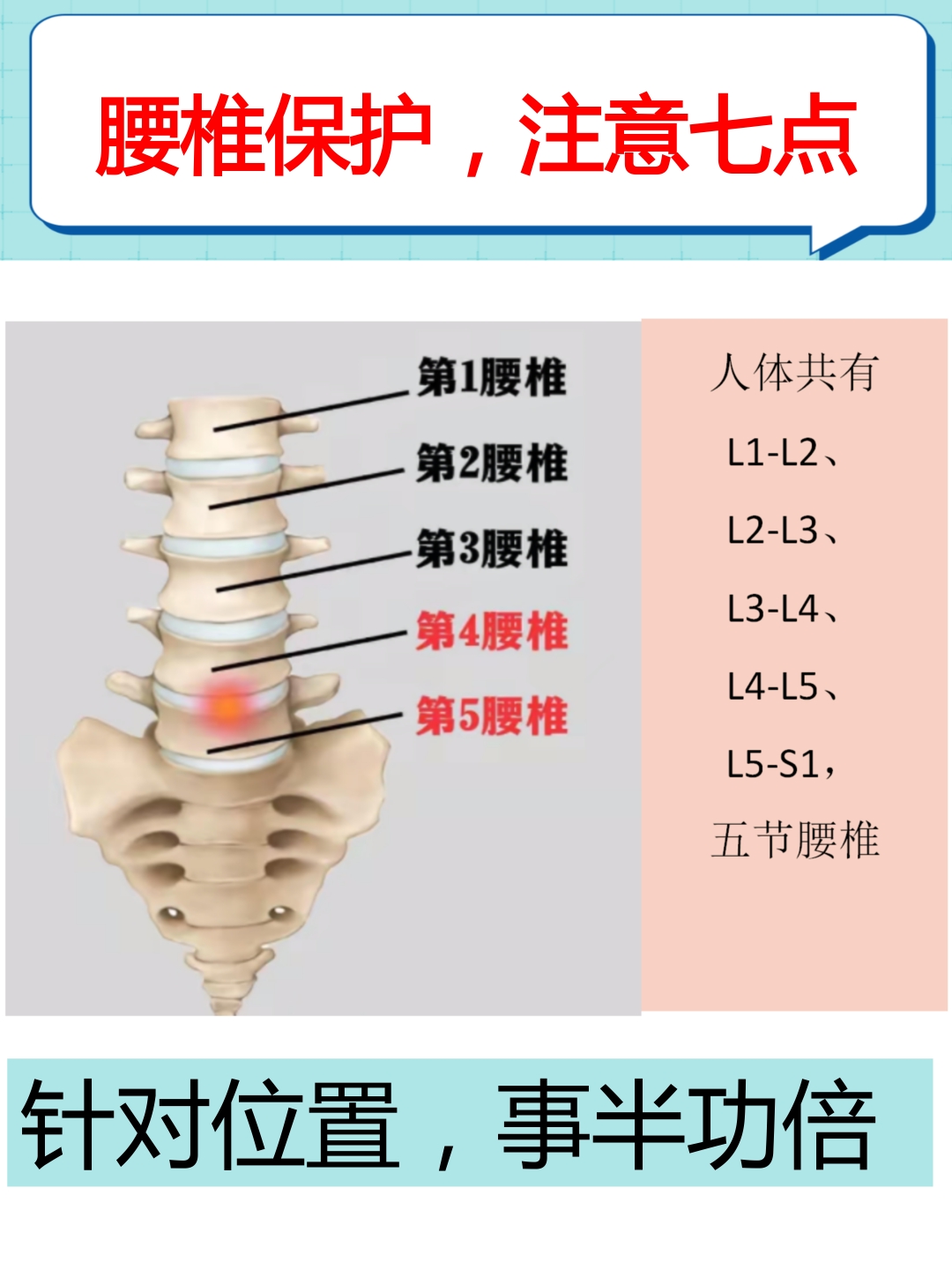 腰痛位置图图片