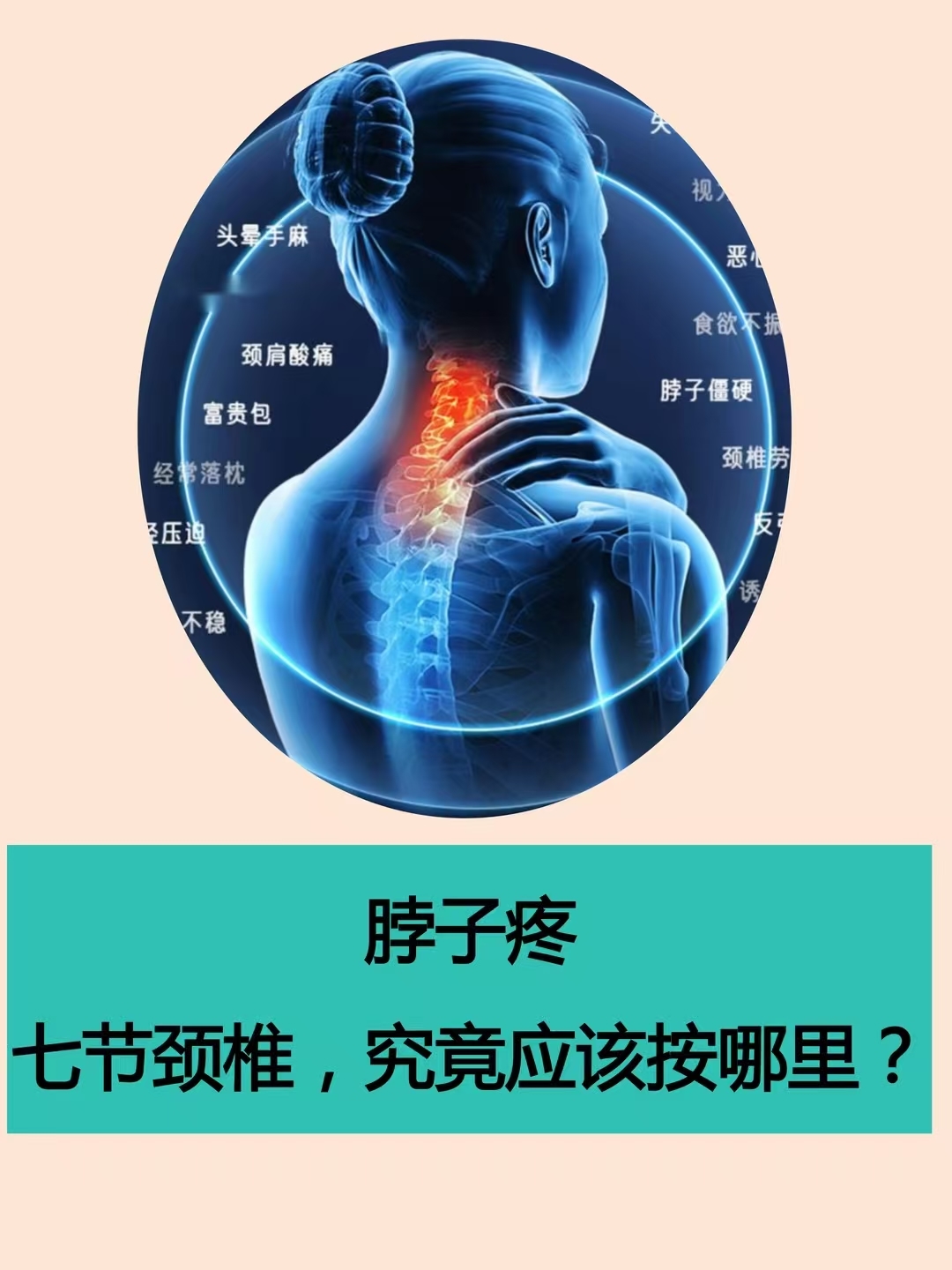 其实,没有外伤情况下,颈椎局部痛,多数情况是堵塞