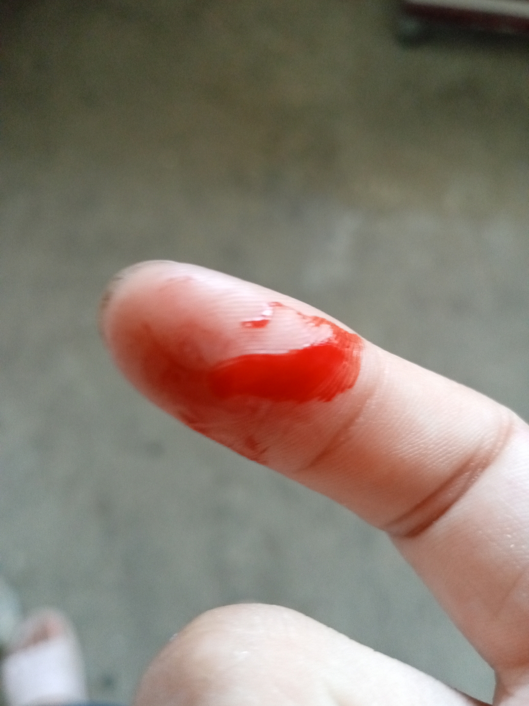 今天确实挺惨的,丁书丁,我不小心扎自己手里了出了好多血,真服了