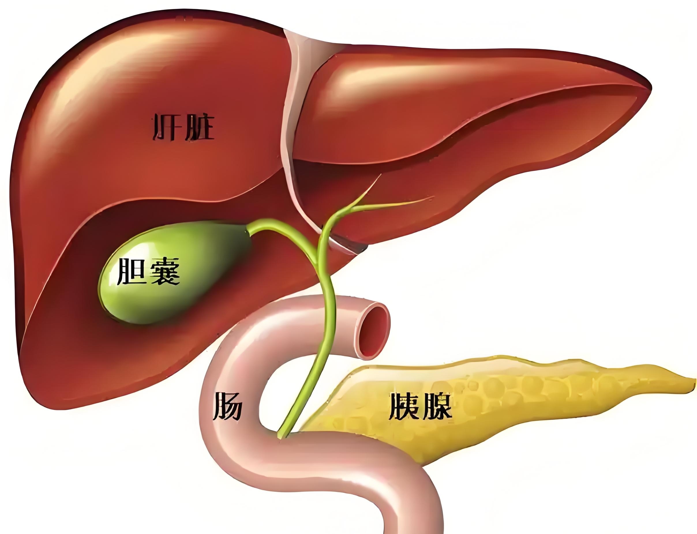 很多人以为胆囊结石就是肾结石,两者是有区别的