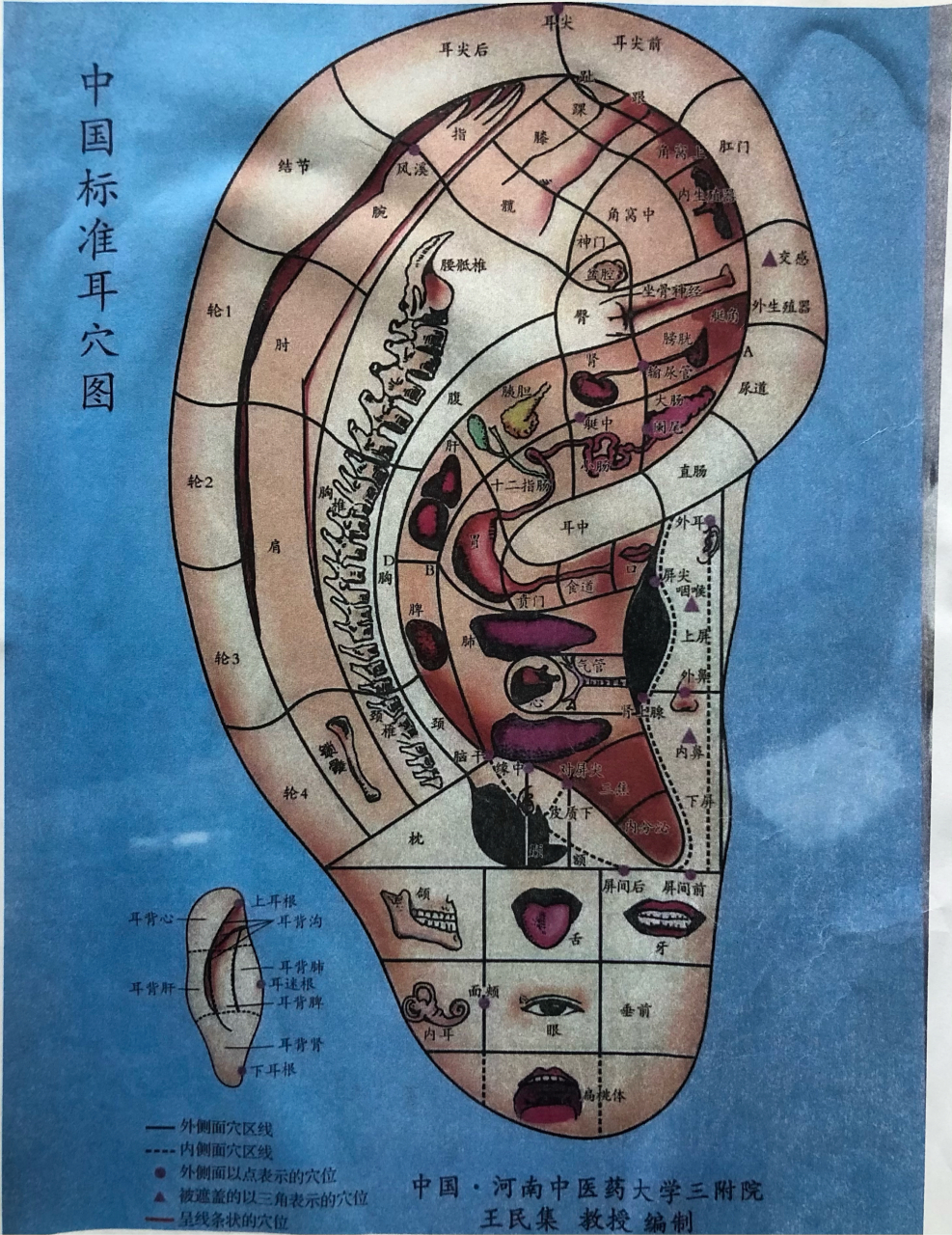 1,耳屎是好东西 耳屎其实很重要,它叫耵聍.