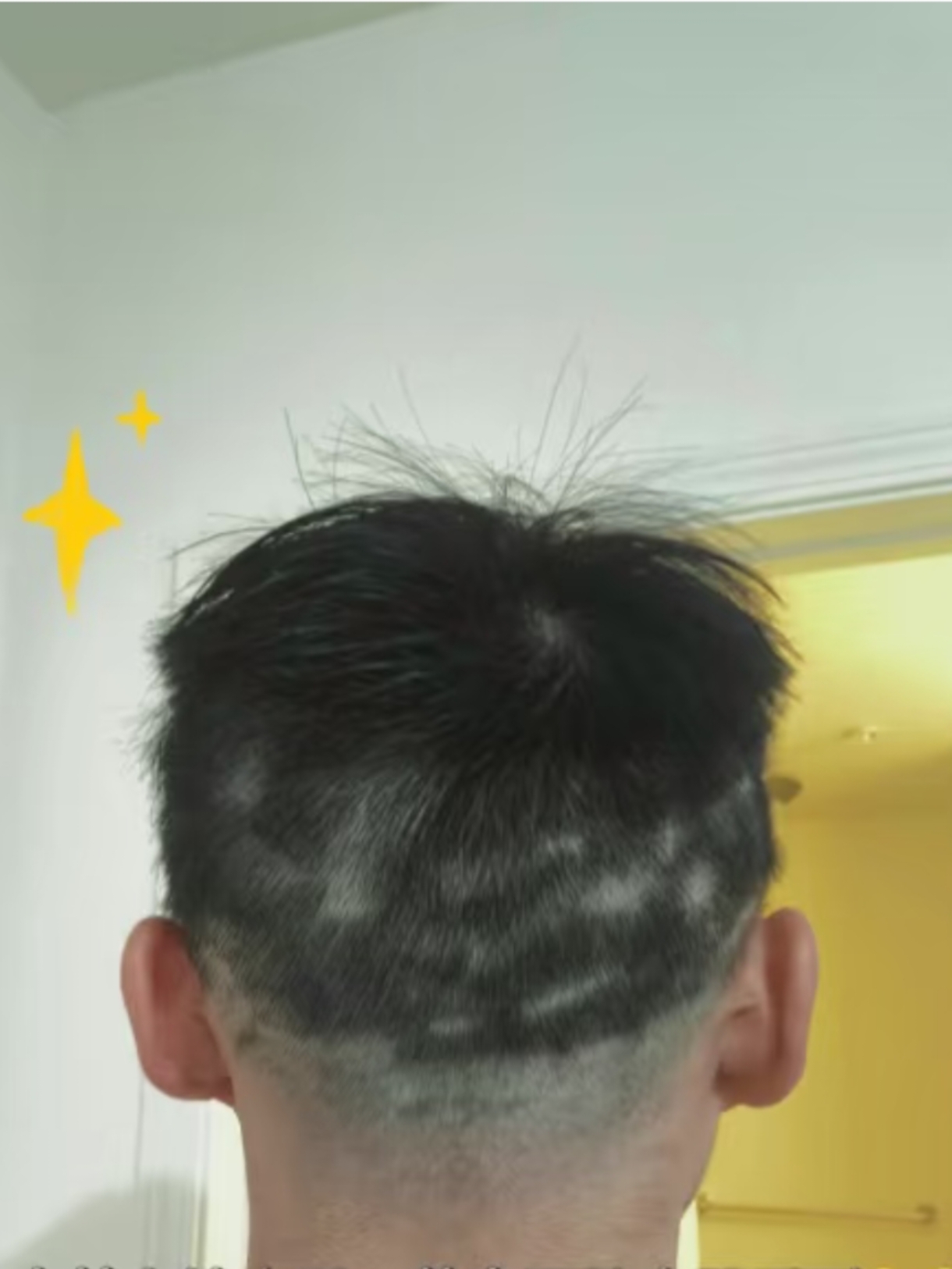 初学者头背剪短梅毒发型头发乱剪成赖子图片头发推坏理发店丑男人图片