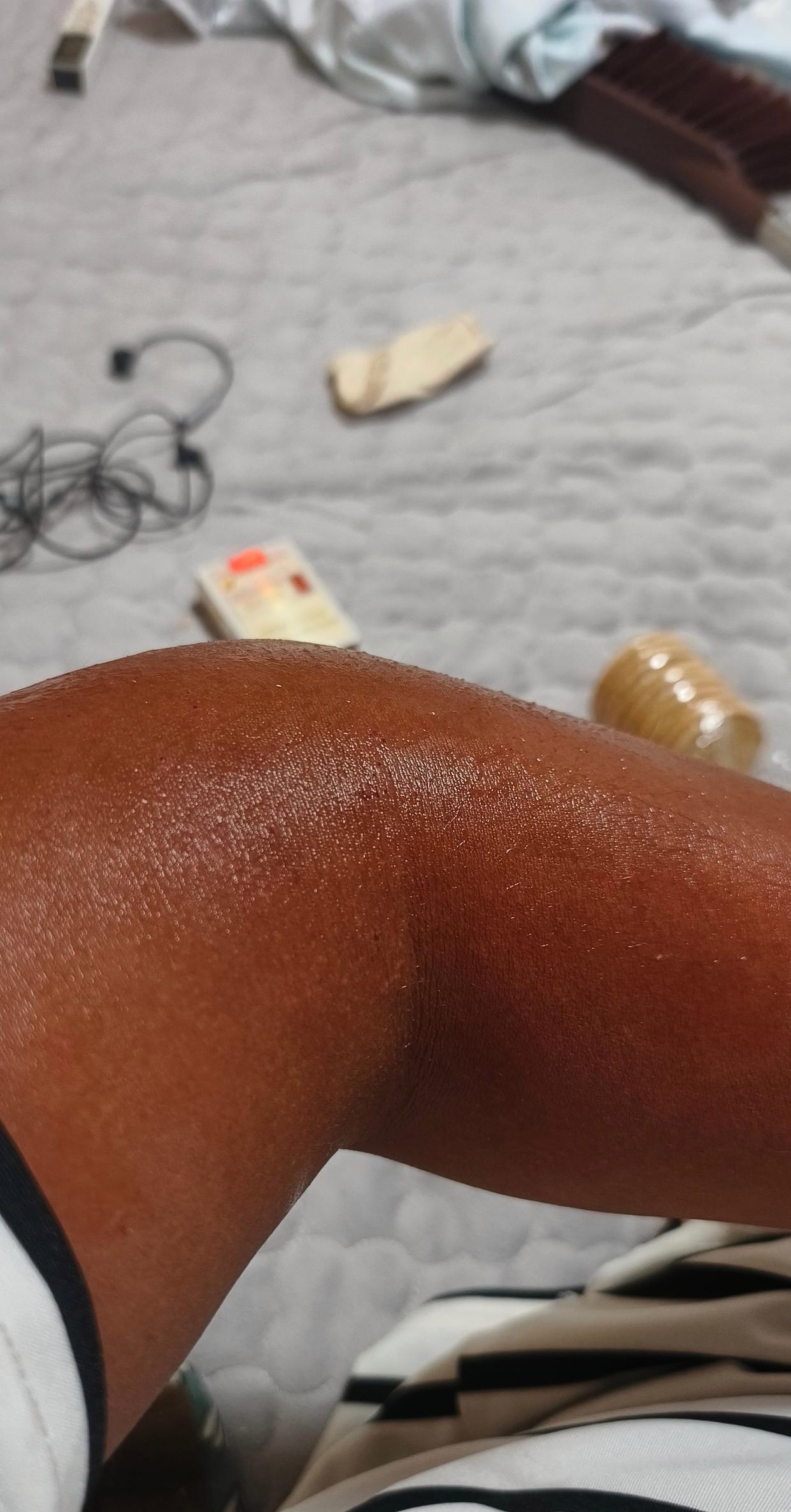 快递小哥送快递到我家,闲聊了几句,看见小哥的胳膊晒的黢黑的,不尽