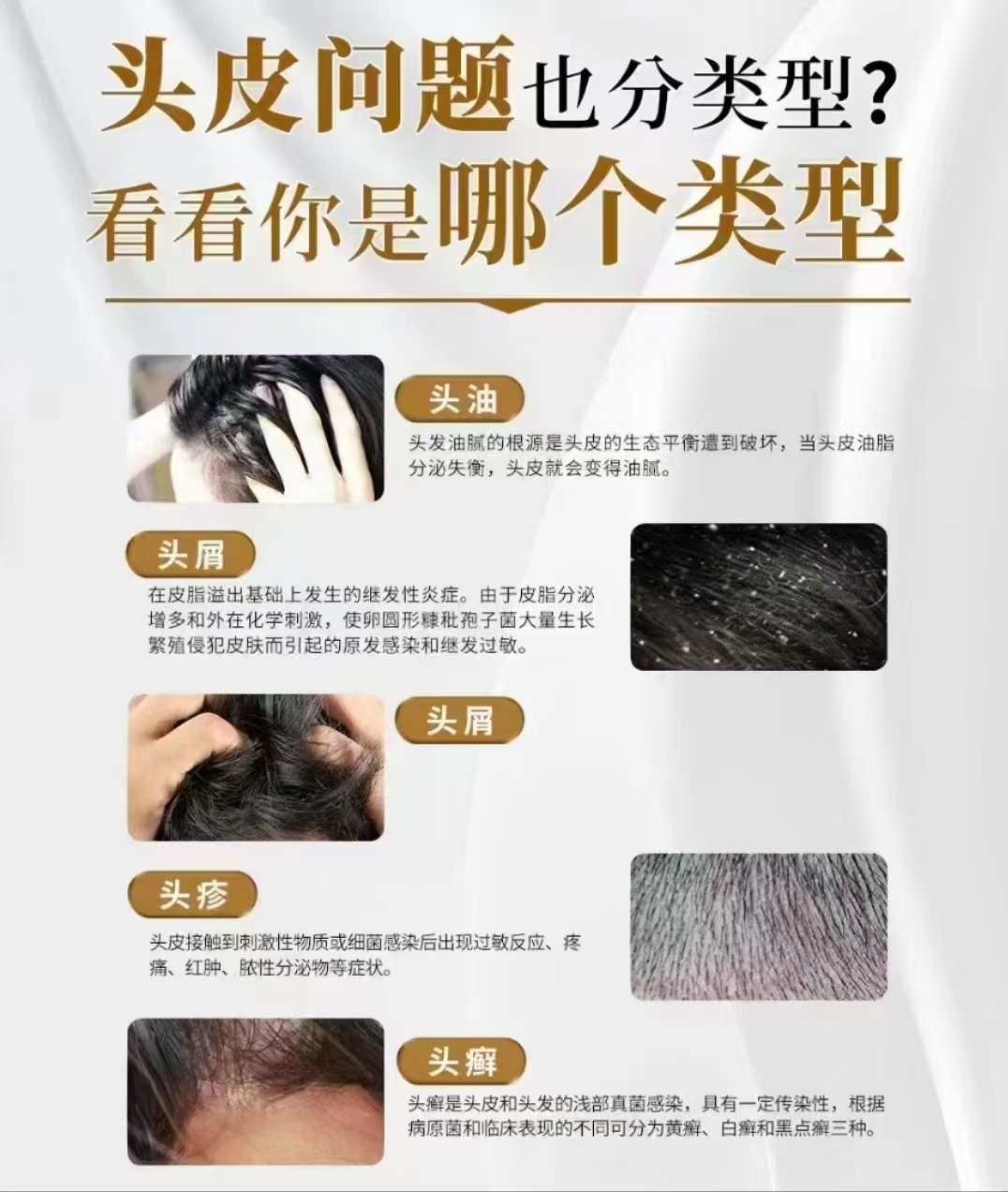 头上有螨虫的4个表现百科在线