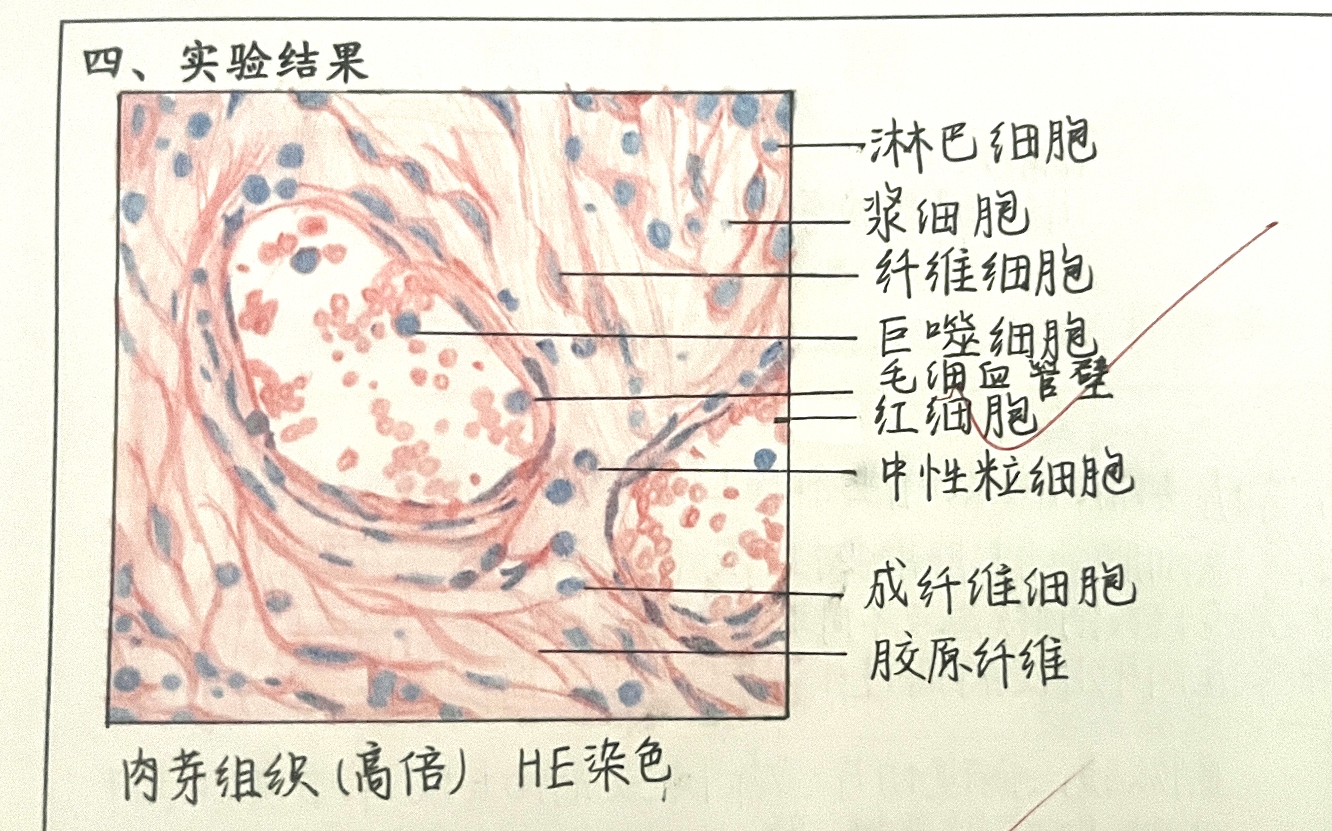 慢性肺淤血红蓝手绘图图片