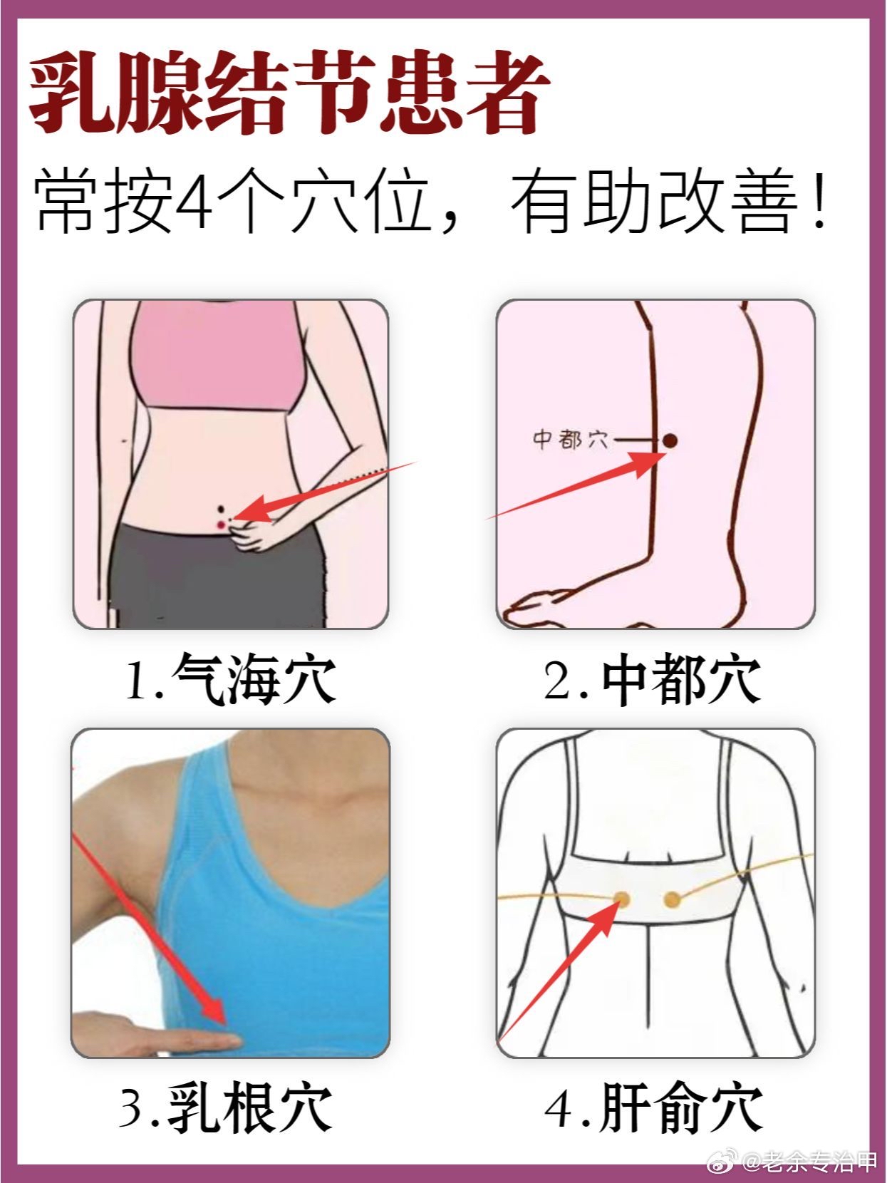 乳腺结节患者