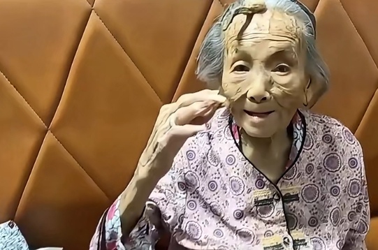 107岁的老人头上长角,老人的孙子说,老人已经长两年了,不痛也不痒