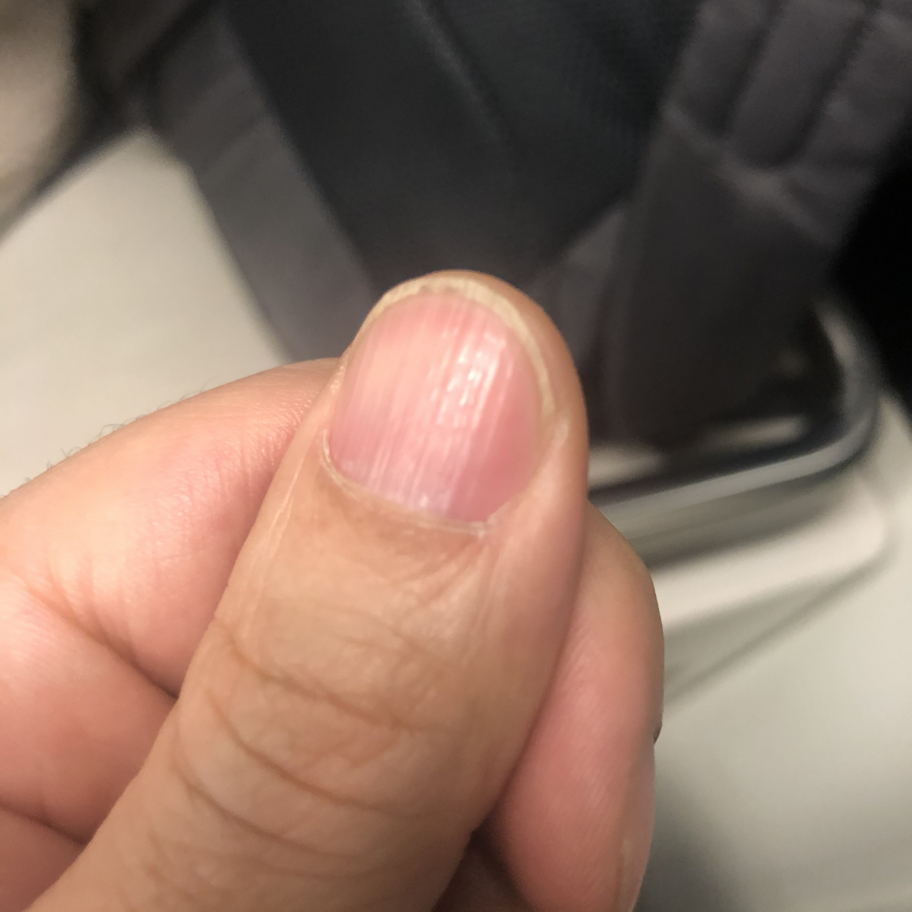 指甲鱼鳞状,咋整