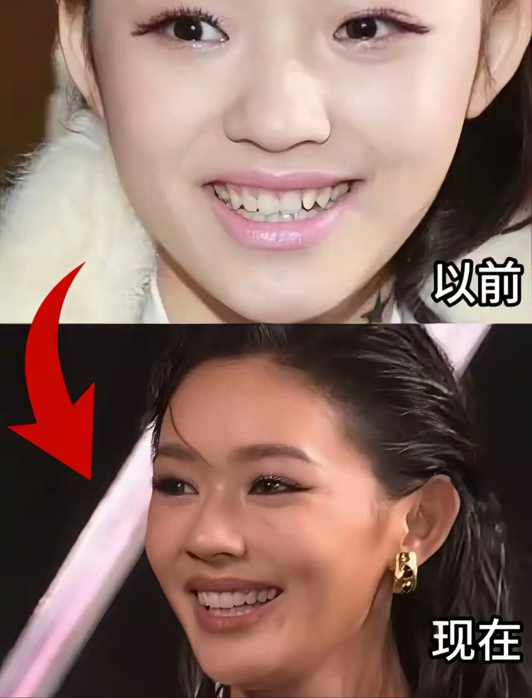 她刚出道的时候,真的算丑的