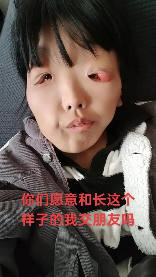 先给你们唠唠我的长相,我这双眼睛不算大,但是笑起来就眯成弯弯的月牙