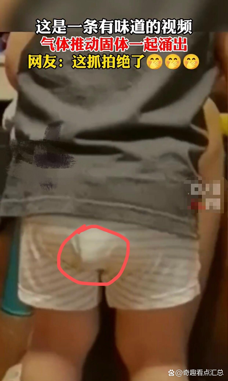什么叫拉裤裆里了?喏,这就是![嘻嘻][嘻嘻][嘻嘻]