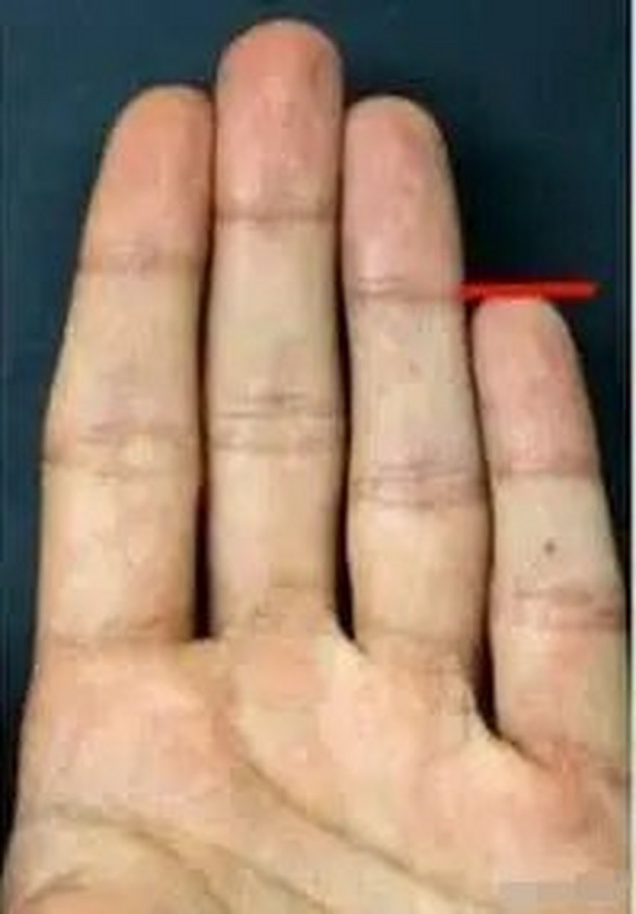 小拇指无名指戴戒指(小拇指和无名指都戴戒指是什么意思)