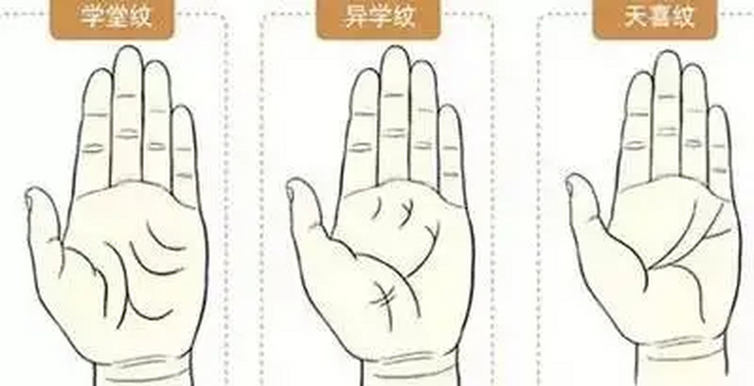 学堂纹/异学纹/天喜纹  学堂纹  形:学堂部位的掌纹细小,美观.