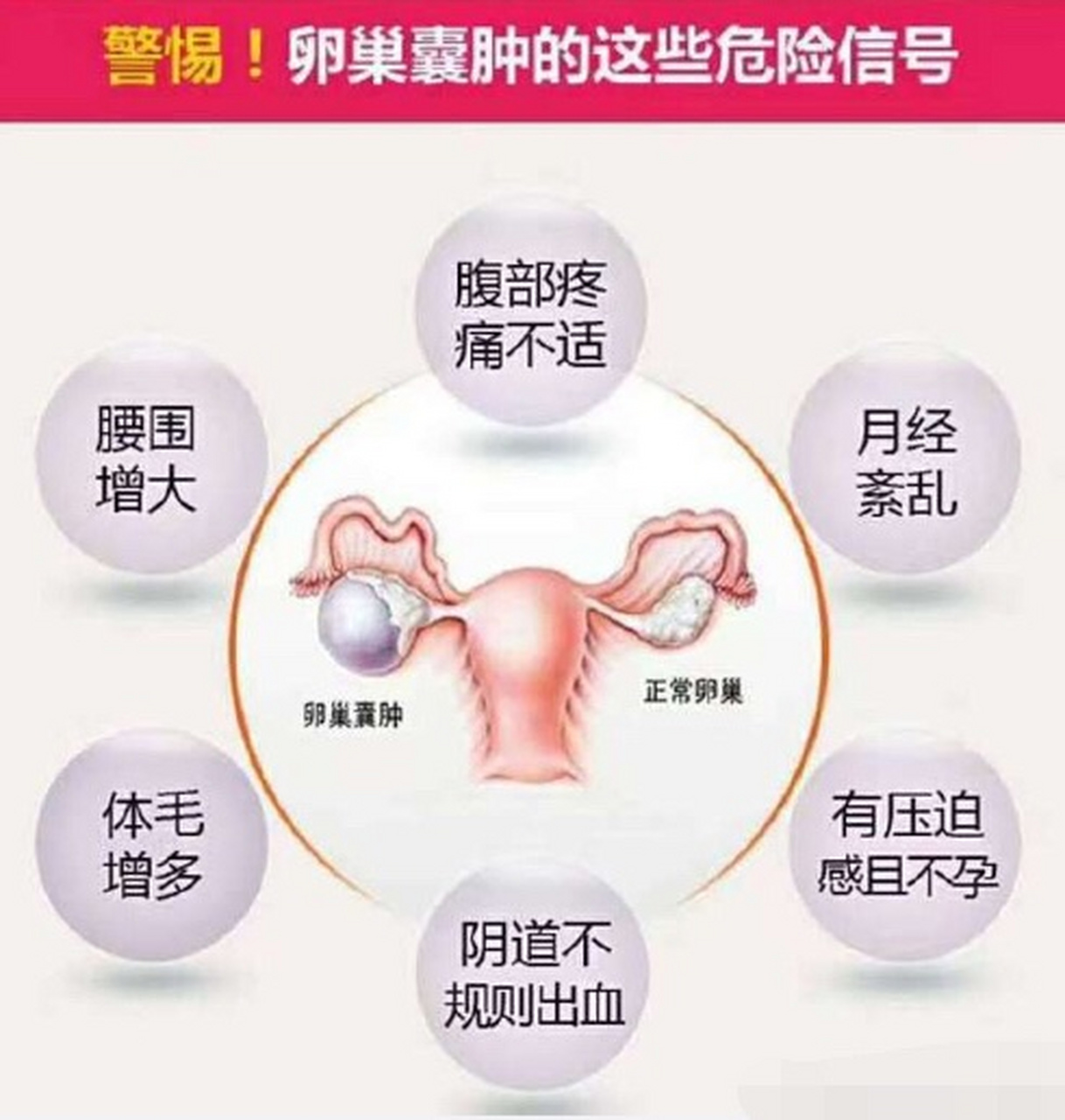 卵巢囊肿大多是由于卵巢产生过多雄激素,而雄激素的过量产生,是由于