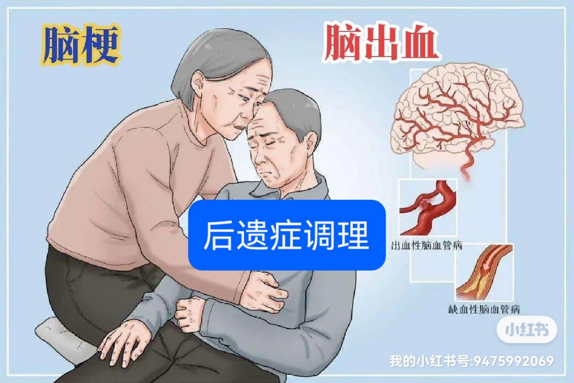 脑梗脑出血后遗症调理:独特方式改善生活质量