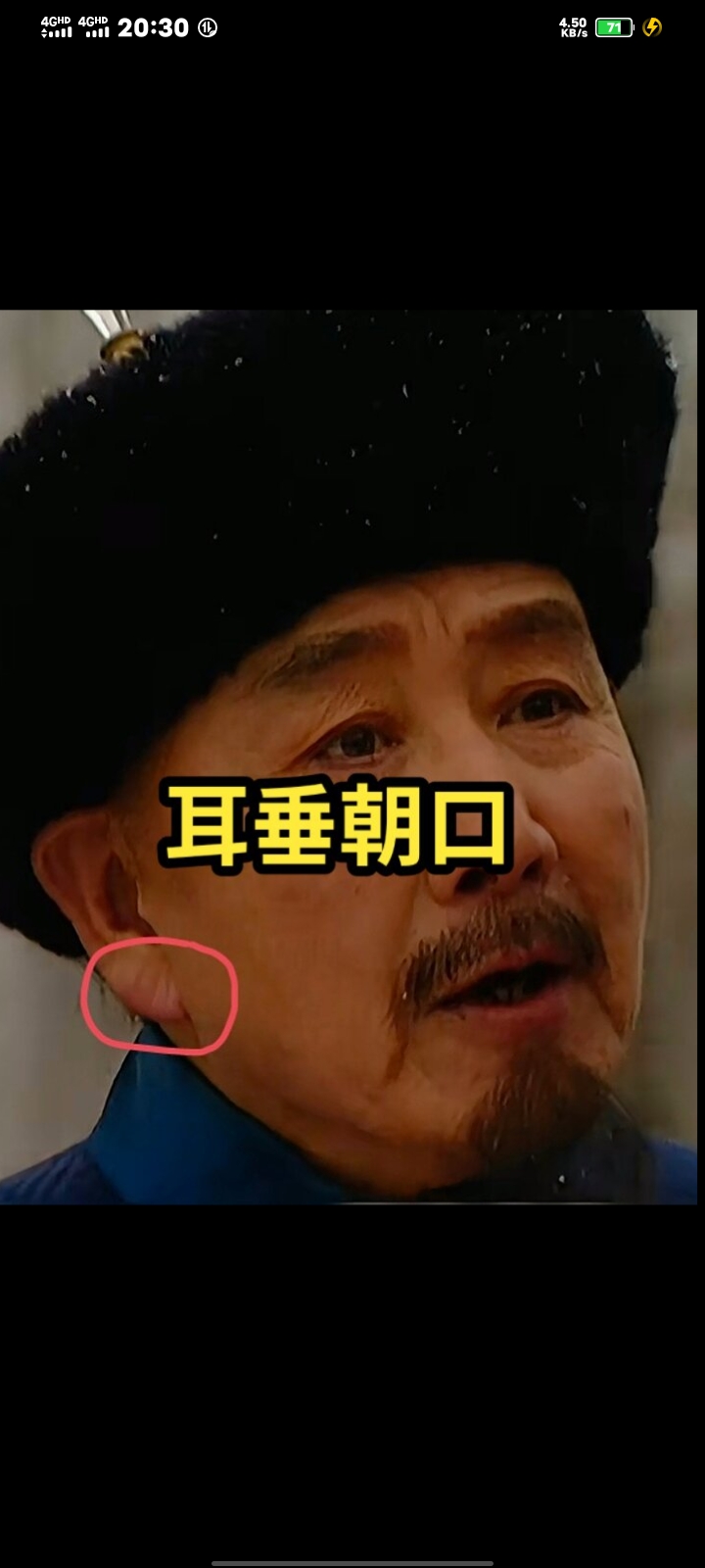 耳垂朝口,耳珠大而丰满并朝向嘴巴,叫"双珠护海口",晚年安康之意,代表