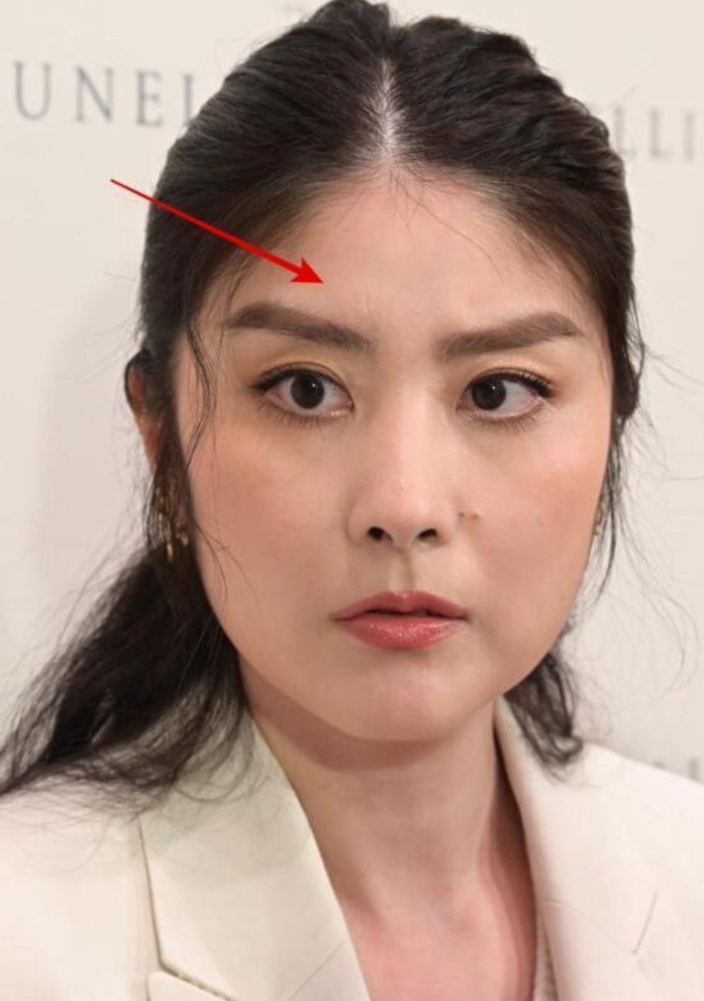 张慧琳这照片没照好吧,还是车祸后在家吃睡太多,女神变大胖脸了.