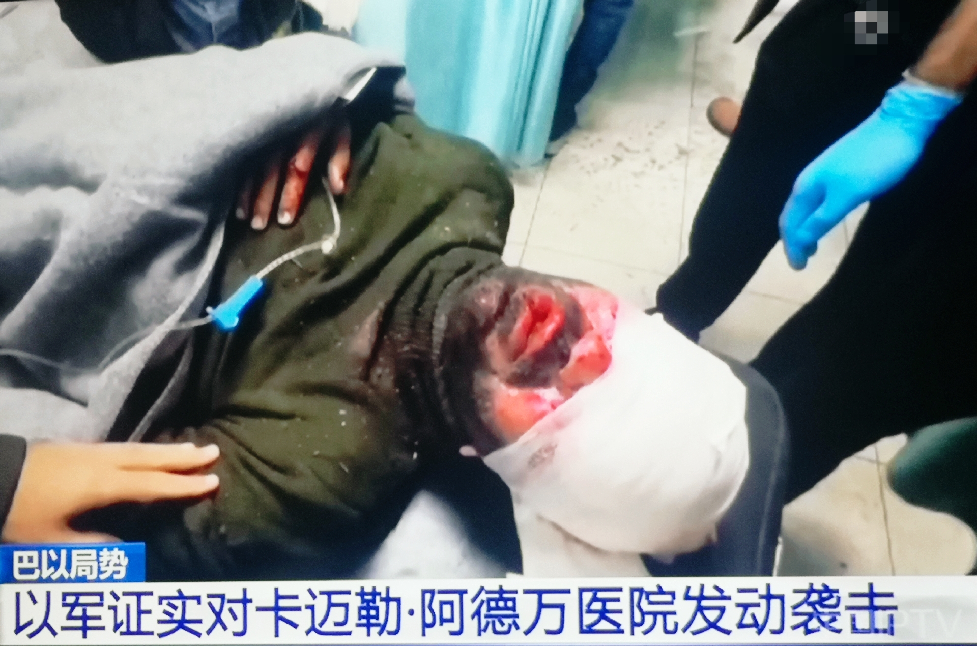 以军烧毁了医院大片区域,并命令数百人离开