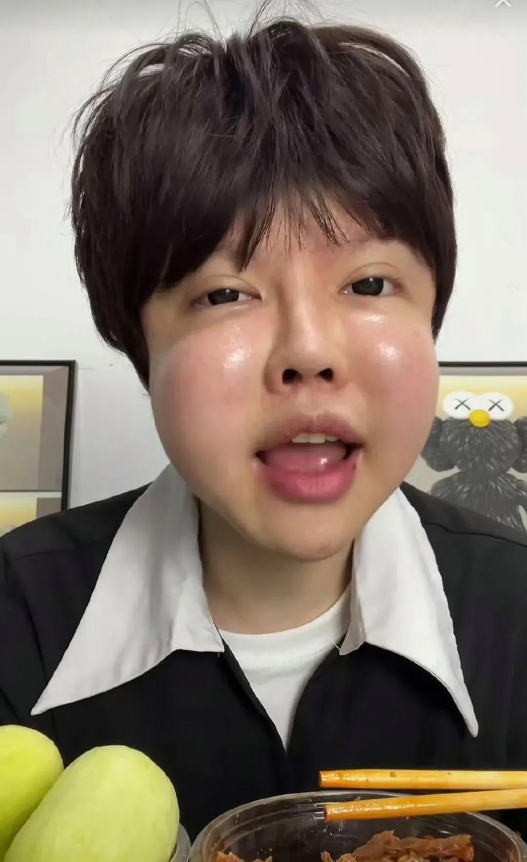 难道不觉得很奇吗玻尿酸脸美国脸上打针打玻尿酸几十年后的脸玻尿酸