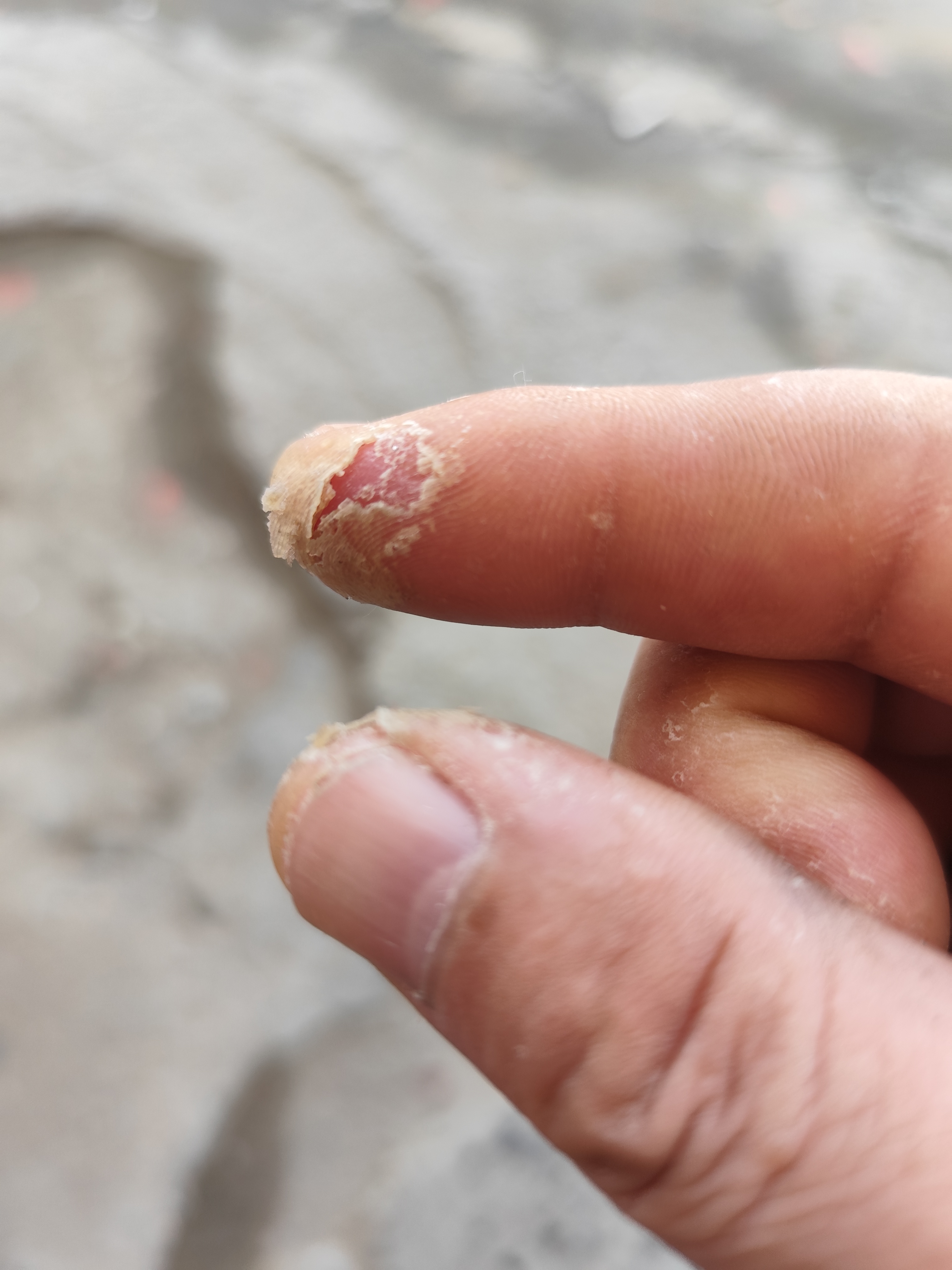 手指老茧开始爆皮 作为男人有苦有泪不能和老婆孩子说,一切都得藏在