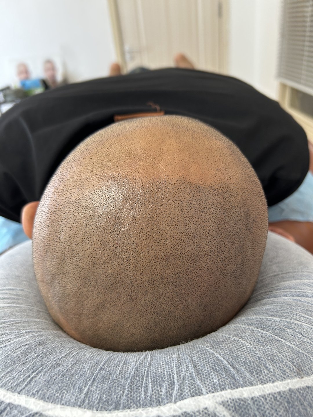 不做秃头小宝贝,不是纹身的纹发