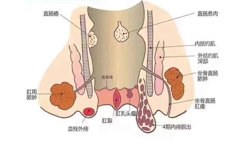 肛门图片是怎样图片