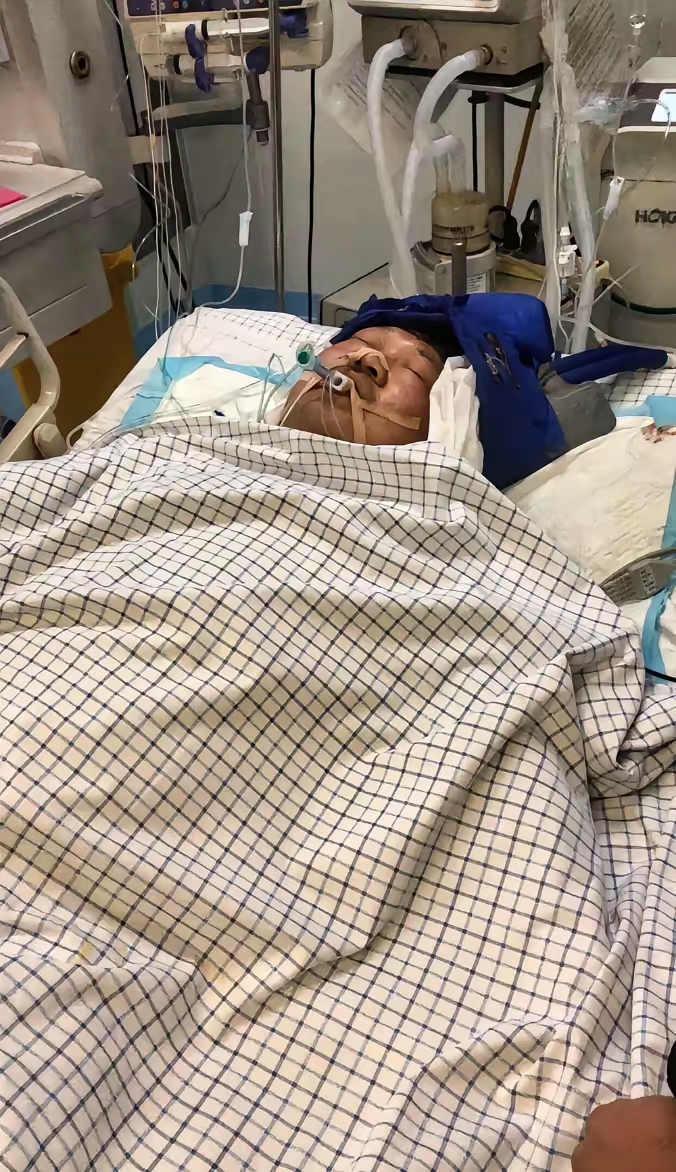 昨天下午快5点突发的,到医院就进了重症室,一直昏迷不醒