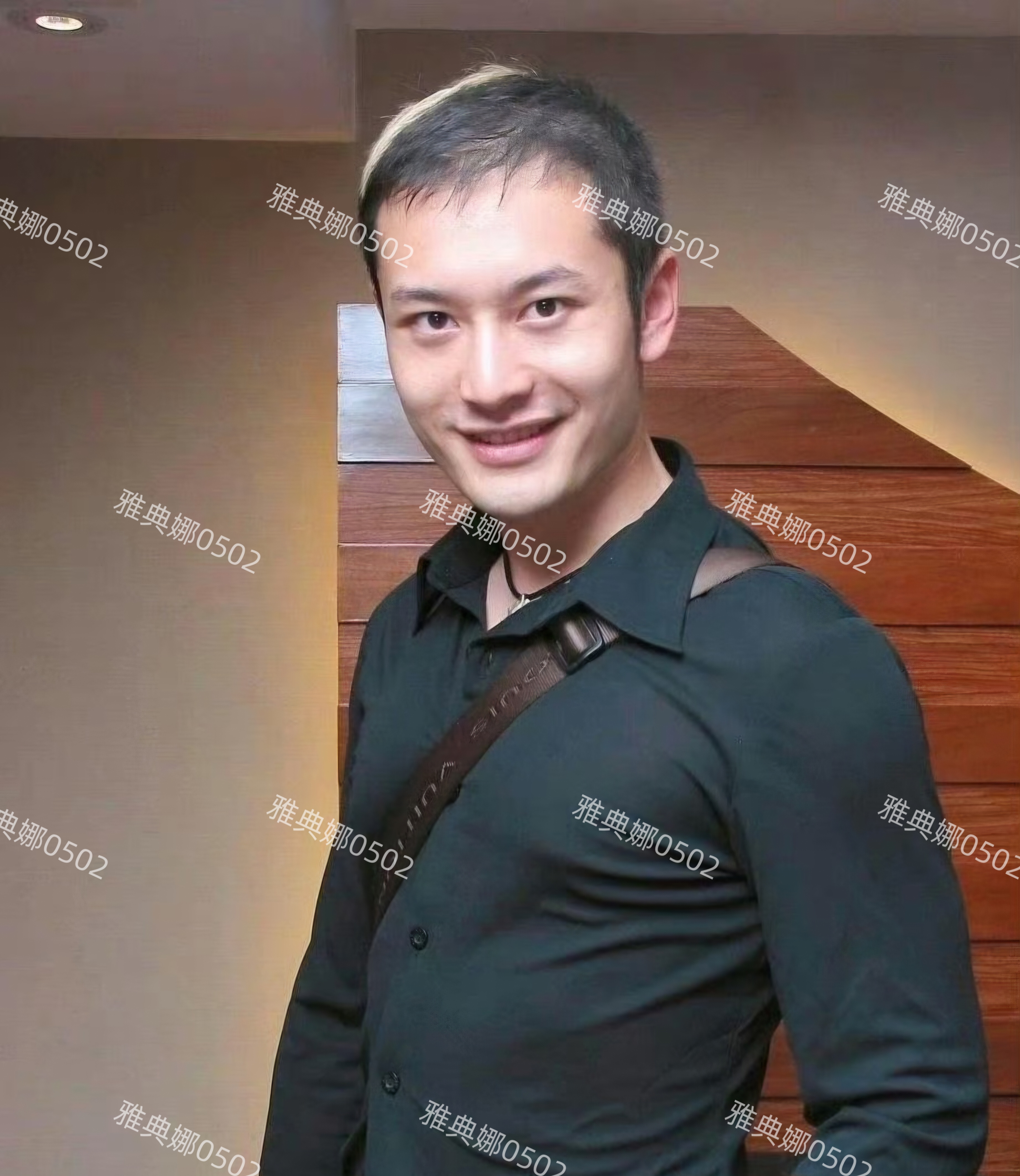 假发男植发(假发与植发有什么区别)
