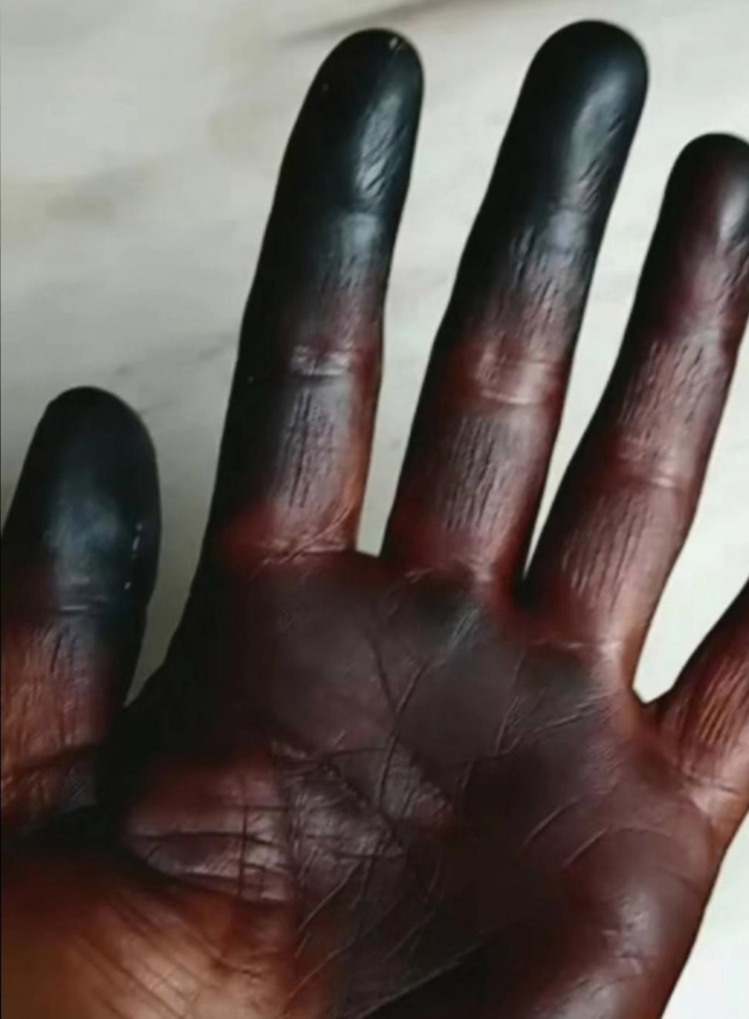 今天为了吃口新鲜的核桃把自己原本白皙娇嫩的手掌弄成这样,也不知道