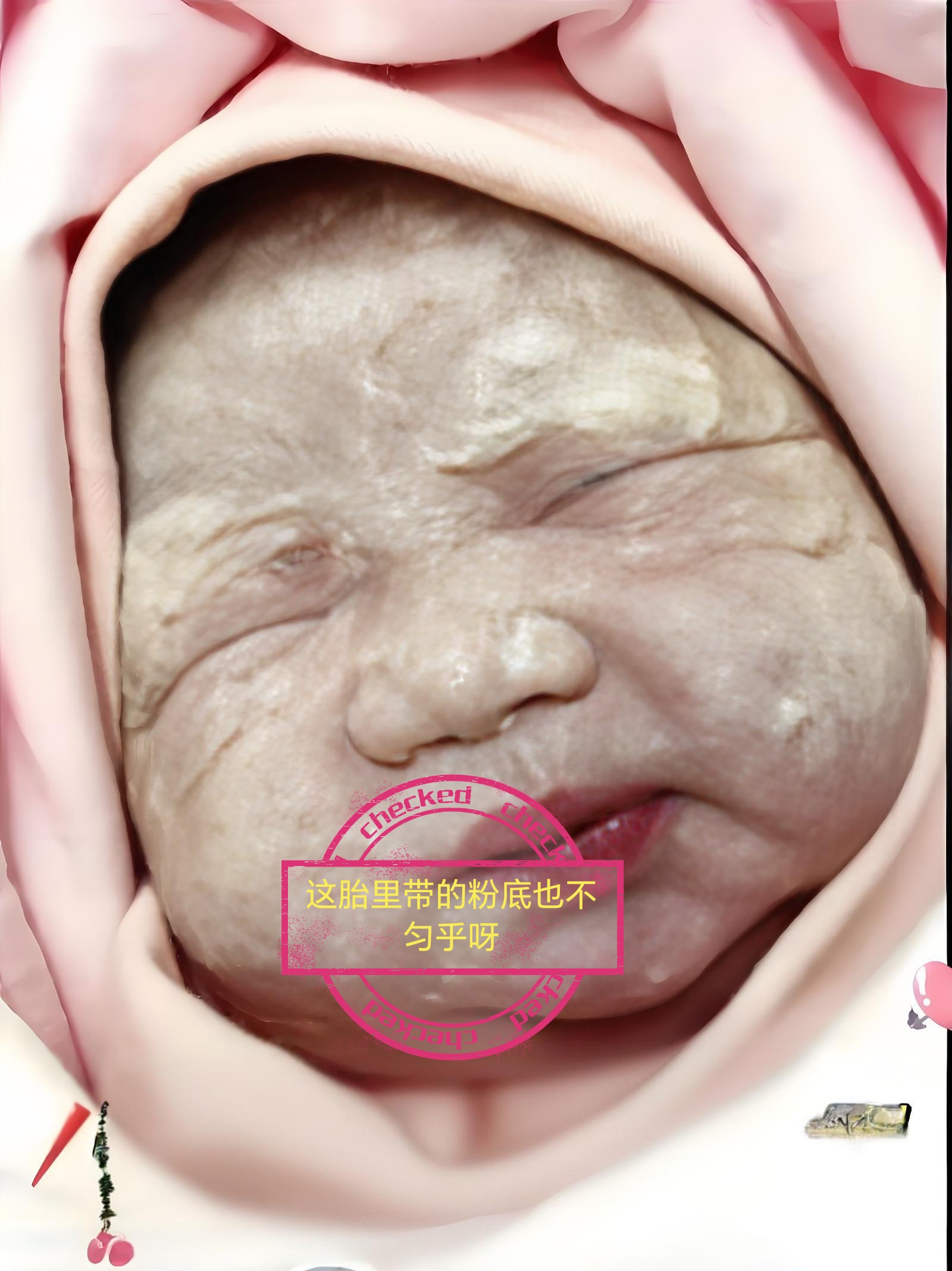 综合征胎儿的特点宝宝出生为什么会有胎脂宝宝生完之后脸上外胚层发育