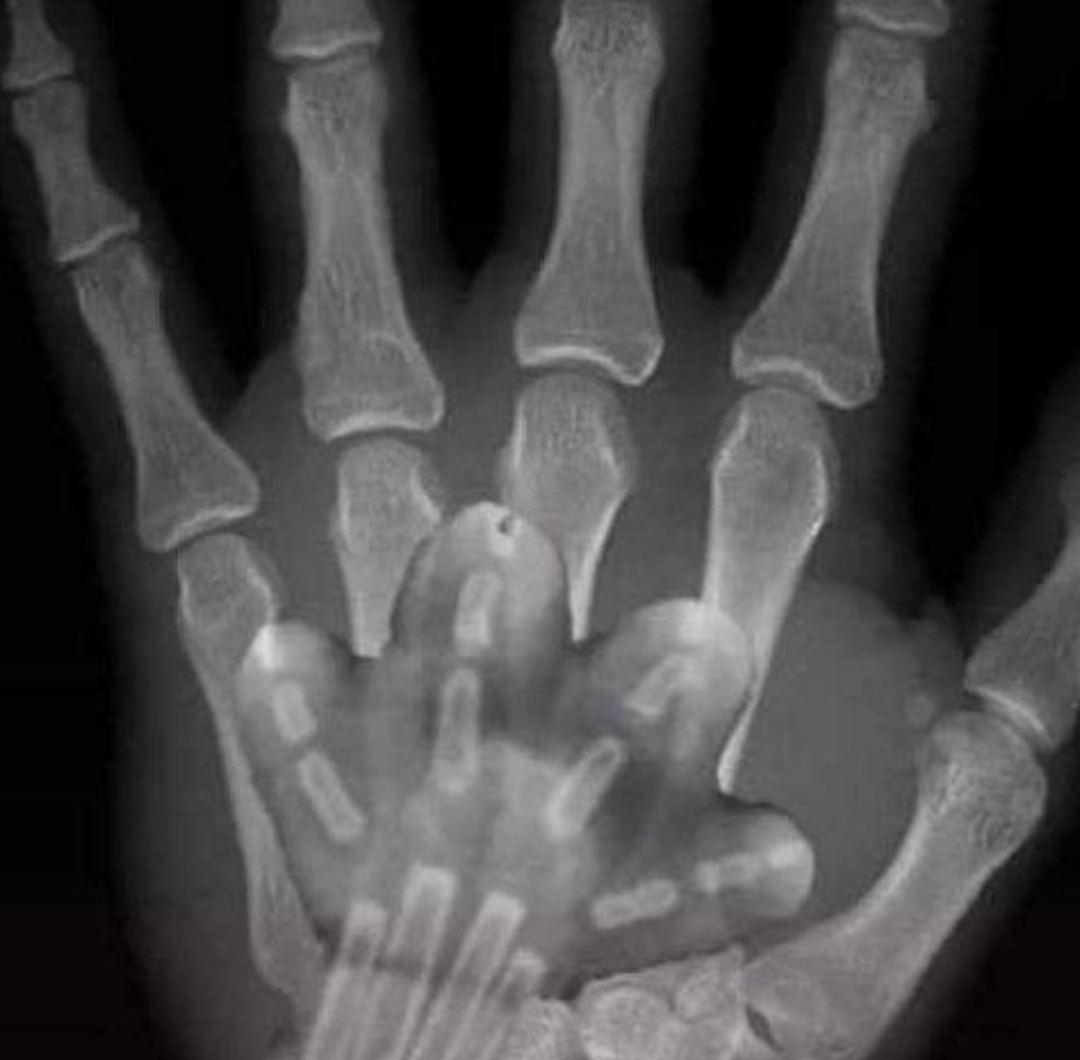 这肉乎乎的猫爪在x光拍摄下显得格外的可爱!